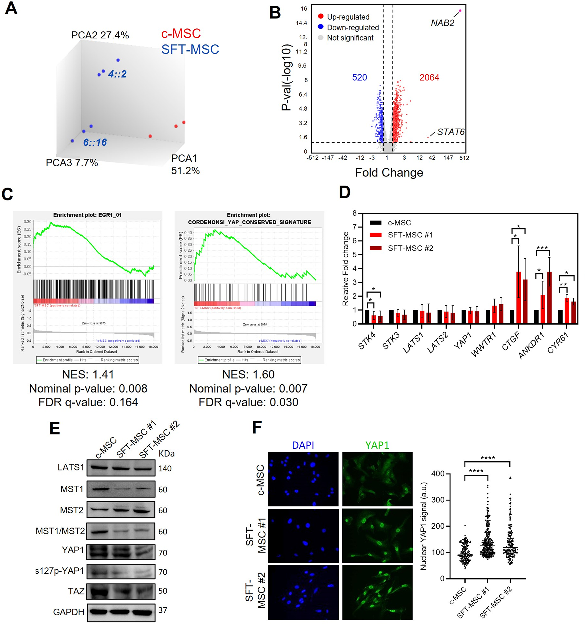 Hippo signalling pathway mediates oncogenic properties of NAB2::STAT6 in solitary fibrous tumour