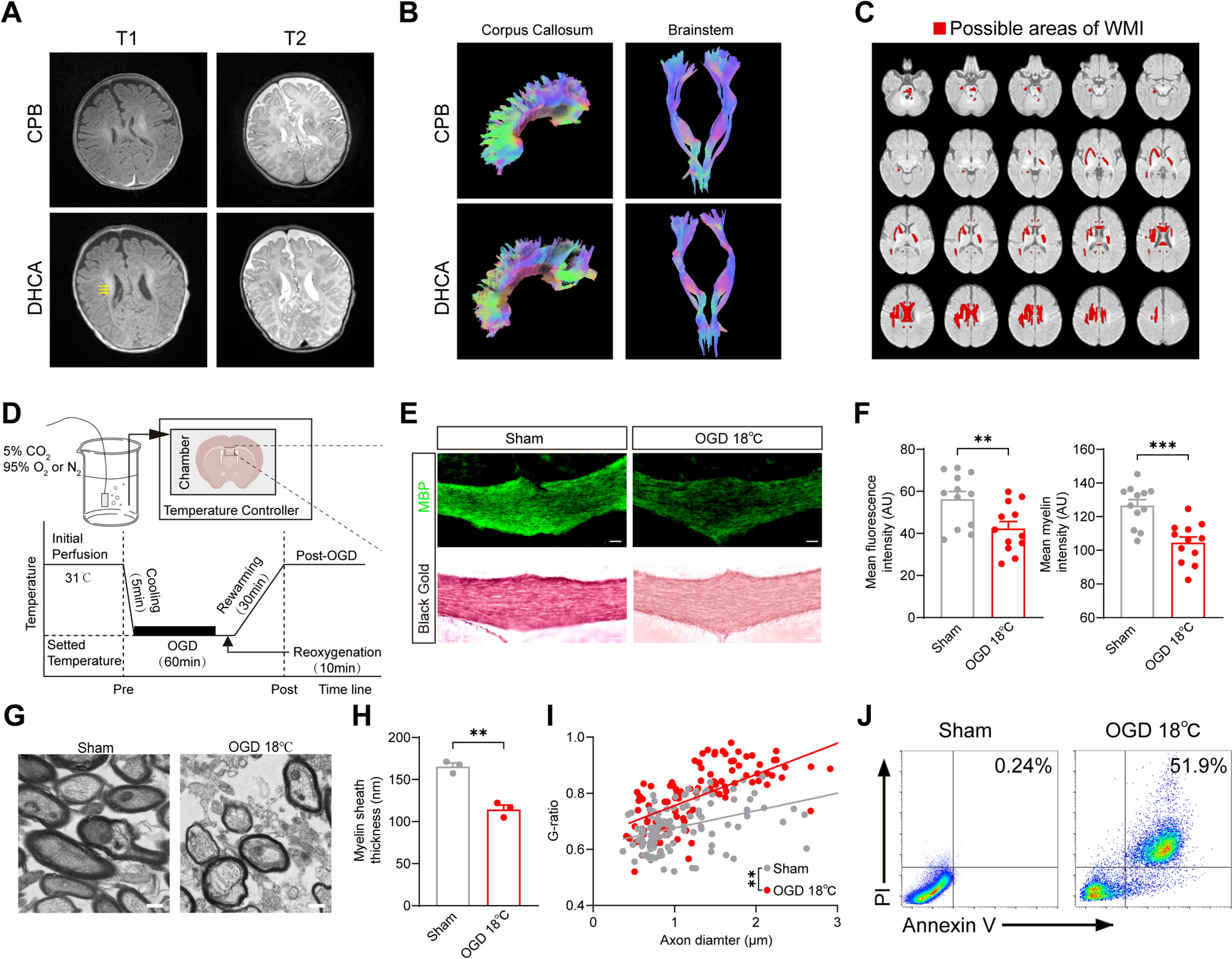 Microglia Pyroptosis-Derived IL-18 Drives White Matter Injury in Developing Brain following Hypothermic Hypoxia-Ischemia