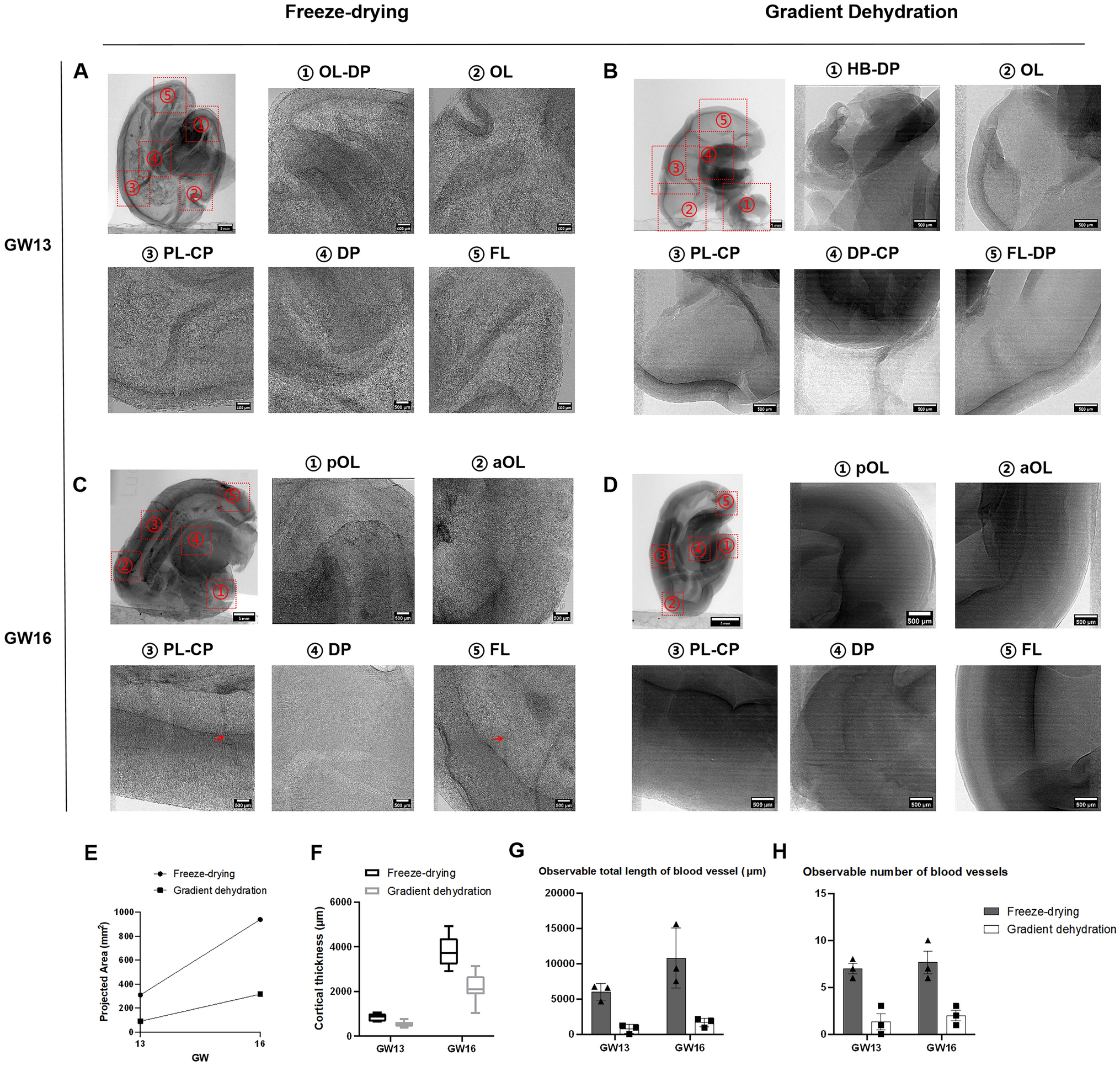Comparison of Freeze-drying and Gradient Dehydration Treatment on X-ray Imaging for Three-dimensional Reconstruction of Early Human Embryonic Brain Samples