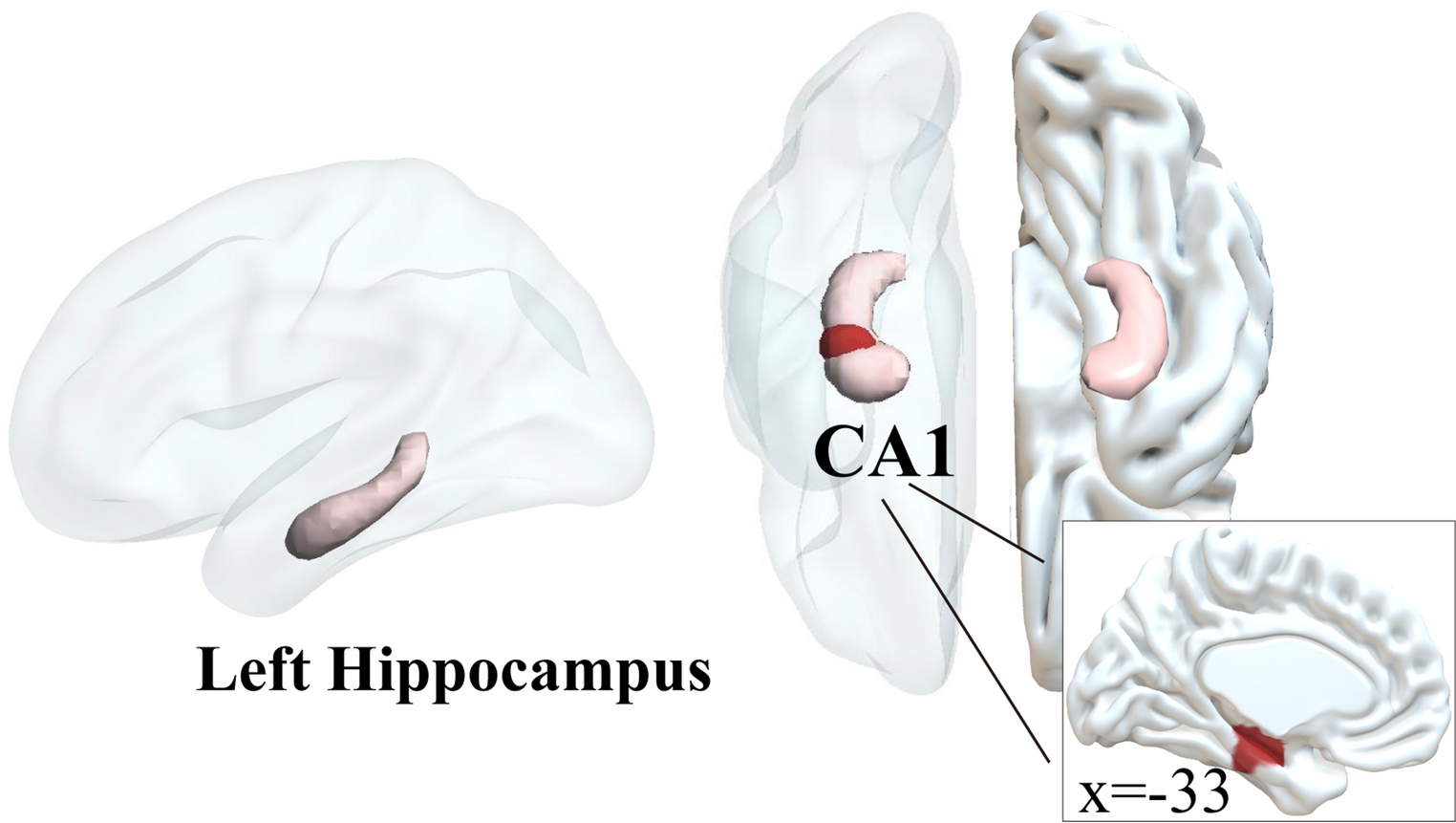 State and trait serotonin variations interact to shape the intrinsic connectivity and gradient architecture of the brain – a combined TPH2 genetics and tryptophan depletion study in men