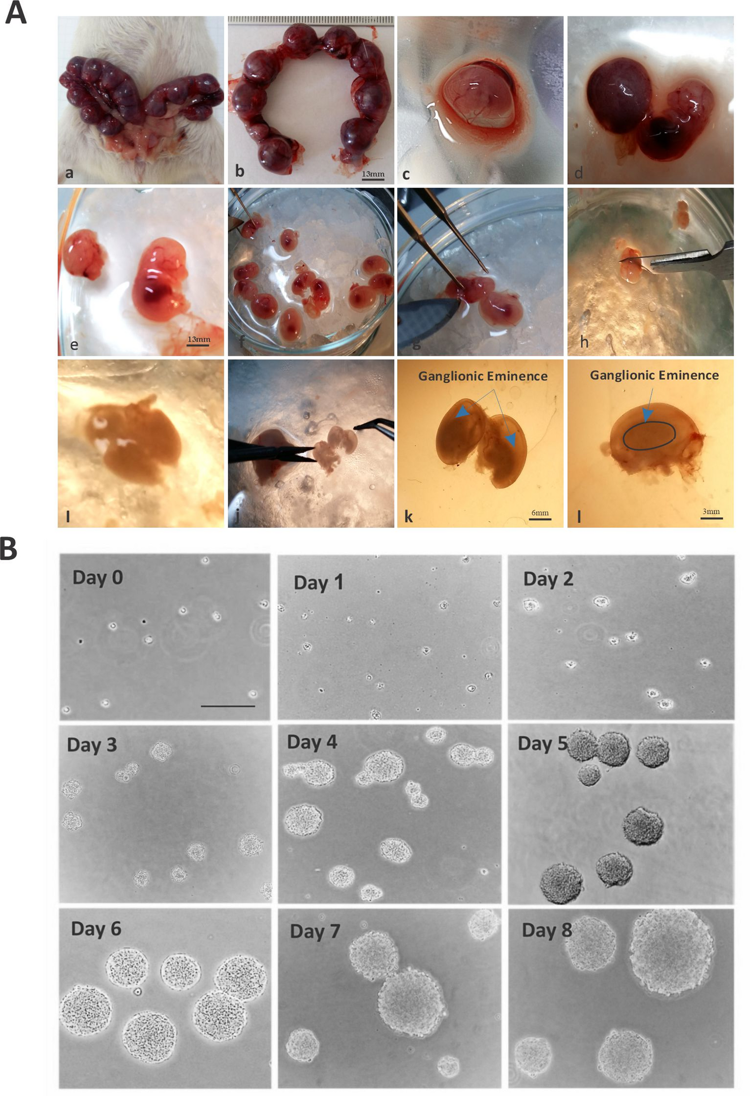 A Balanced Cannabinoids Mixture Protects Neural Stem/progenitor Cells from CoCl2 Induced Injury by Regulating Autophagy and Inflammation: An in Vitro Study