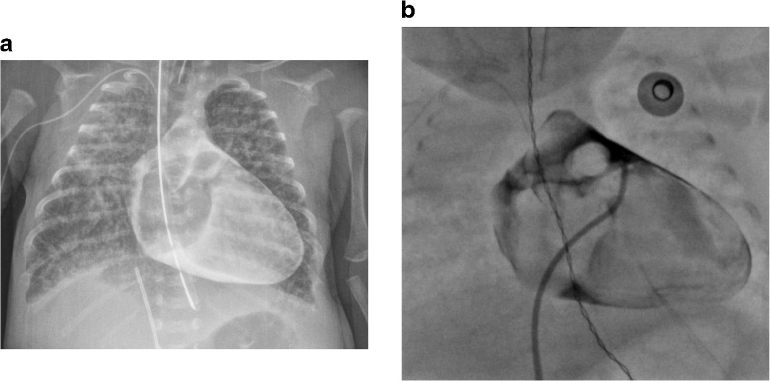 Inadvertent pericardiogram