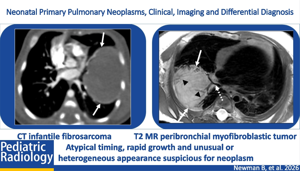 Neonatal primary pulmonary neoplasms, clinical, imaging, and differential diagnosis