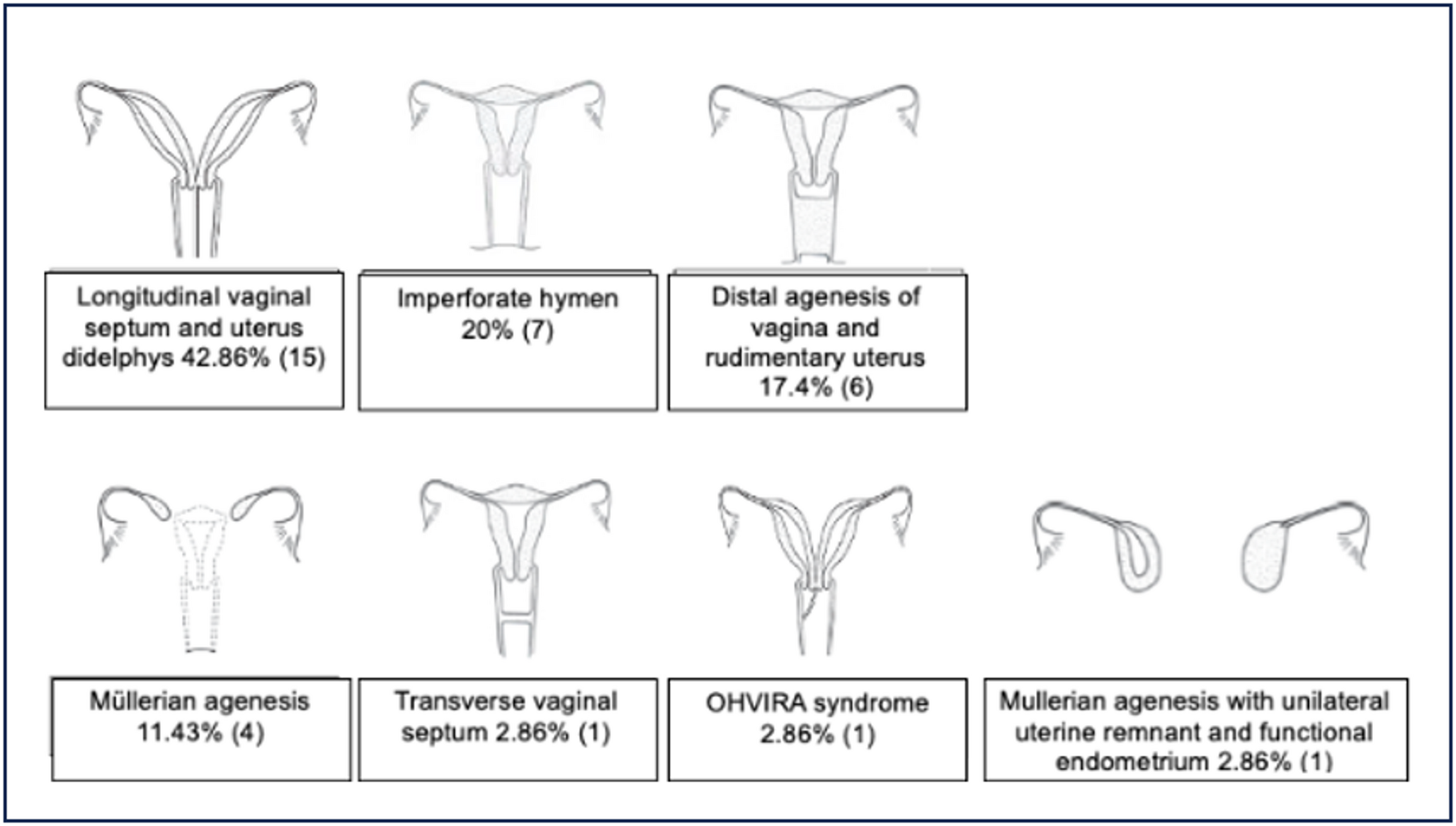 Assessment of quality of life in patients with Müllerian anomalies at a referral center in Colombia