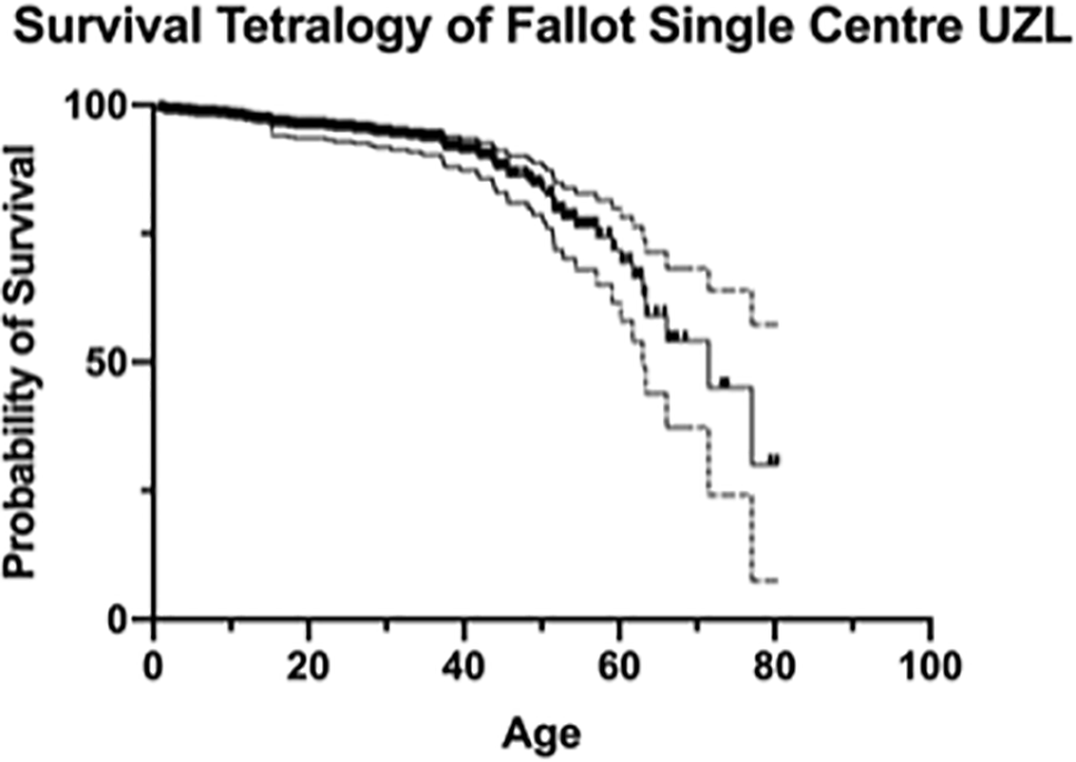 Long-Term Arrhythmic Complications in Patients with Repaired Tetralogy of Fallot: A Single-Center Experience from 1960 to the Present