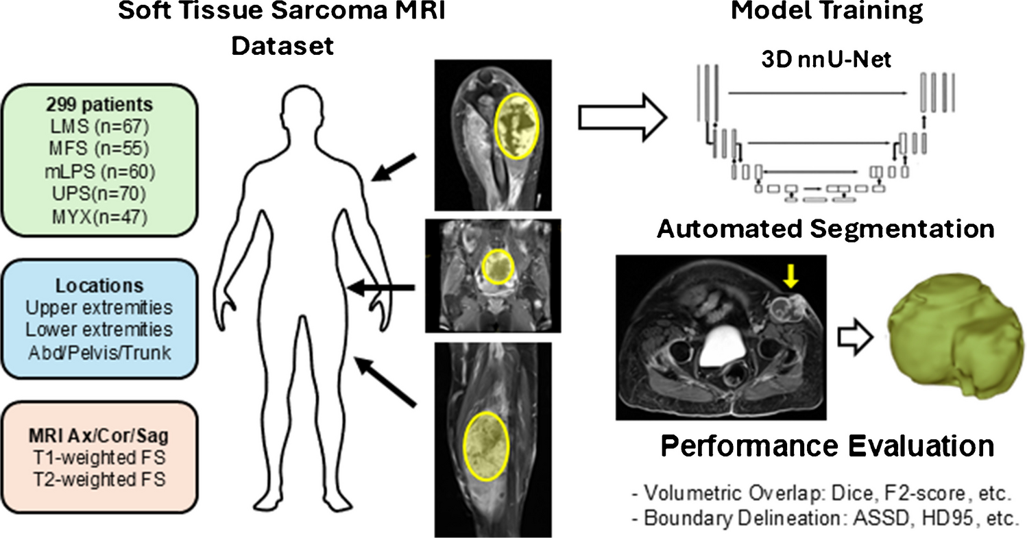 Performance of deep learning-based segmentation of soft tissue sarcoma by MRI sequence, tumor type and location