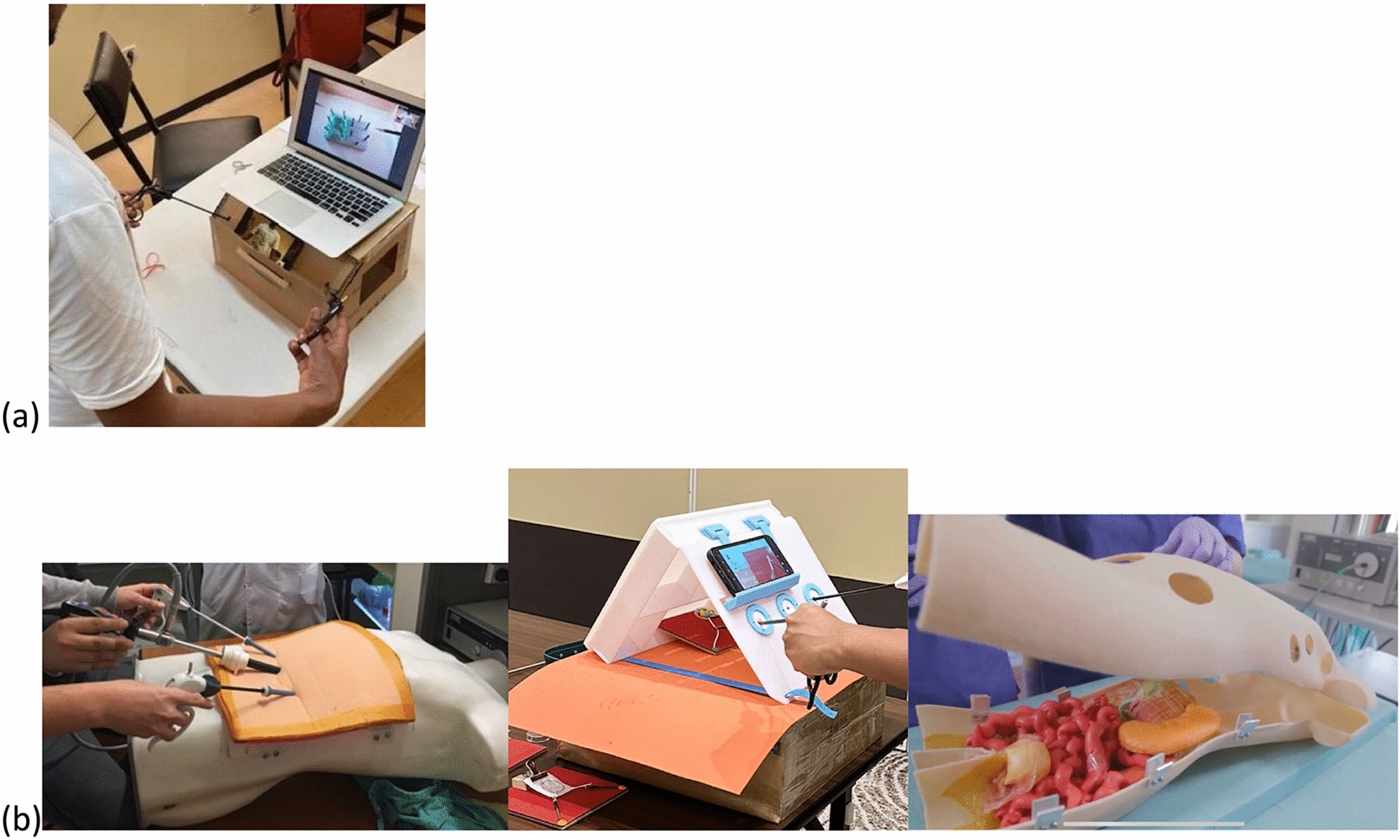 Optimizing the management of laparoscopic equipment in low-resource settings: a SAGES White Paper