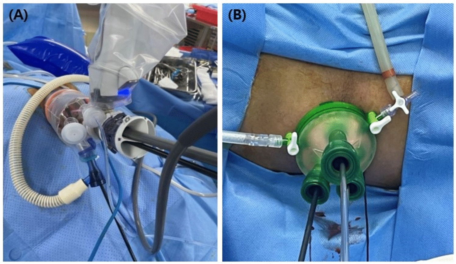 Single-port robotic versus laparoscopic transanal minimally invasive surgery (TAMIS) for rectal neoplasms: a first comparative analysis of surgical efficiency and clinical outcomes