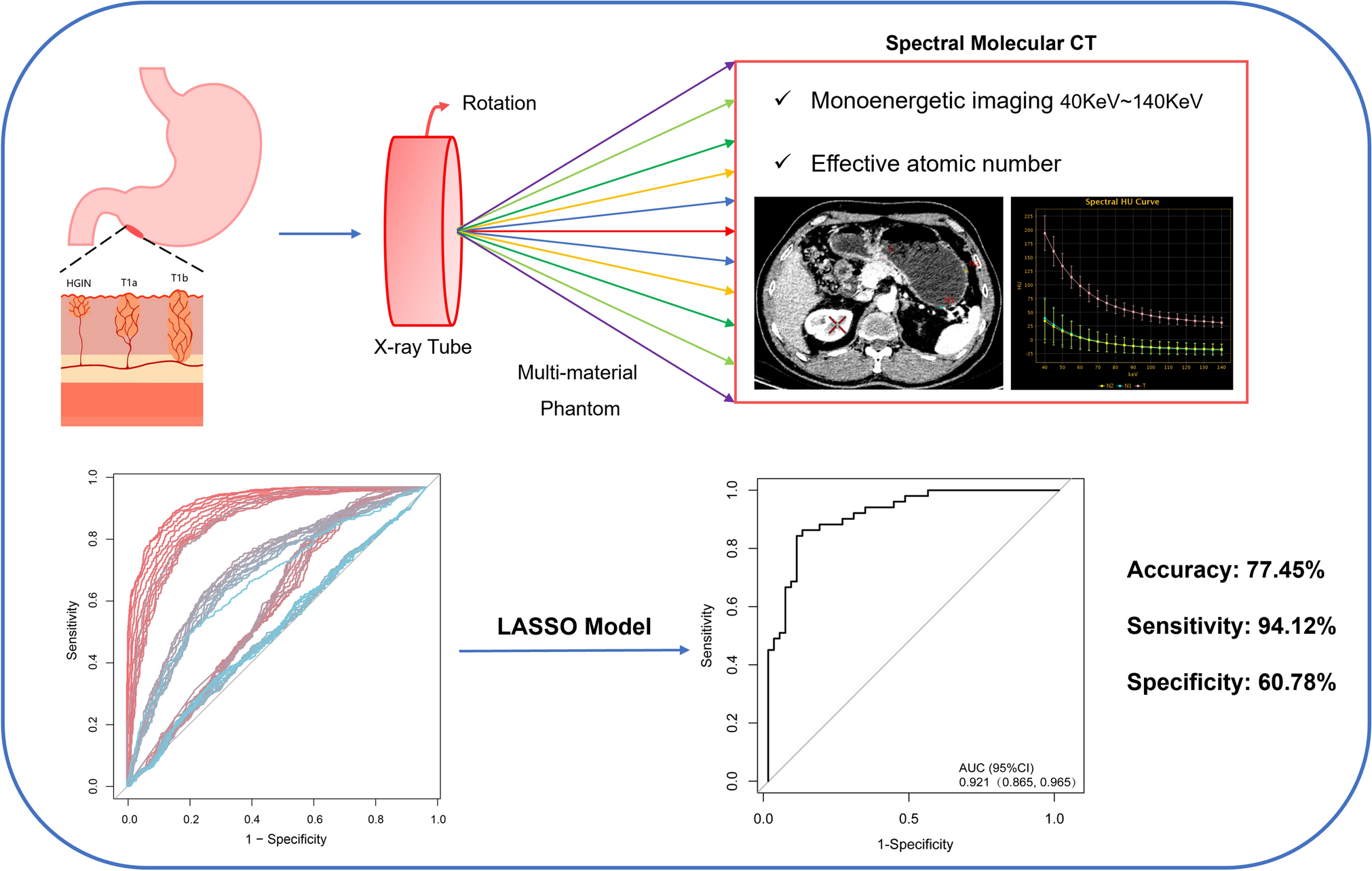 Imaging characteristics and discrimination model development for early gastric cancer using multi-spectral CT