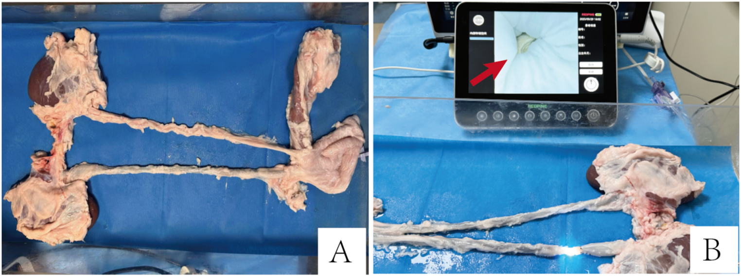 Development and validation of a novel in vitro porcine model for impacted ureteral stones based on objective pressure gradient assessment