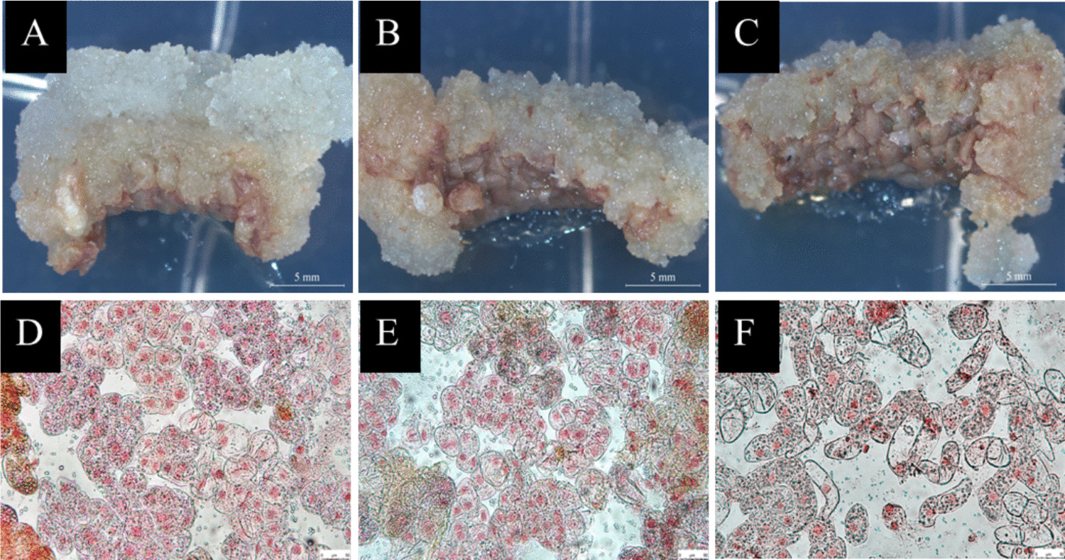 Mechanism analysis of glutamine and acid hydrolyzed casein enhancing the induction of callus in mature  apical buds