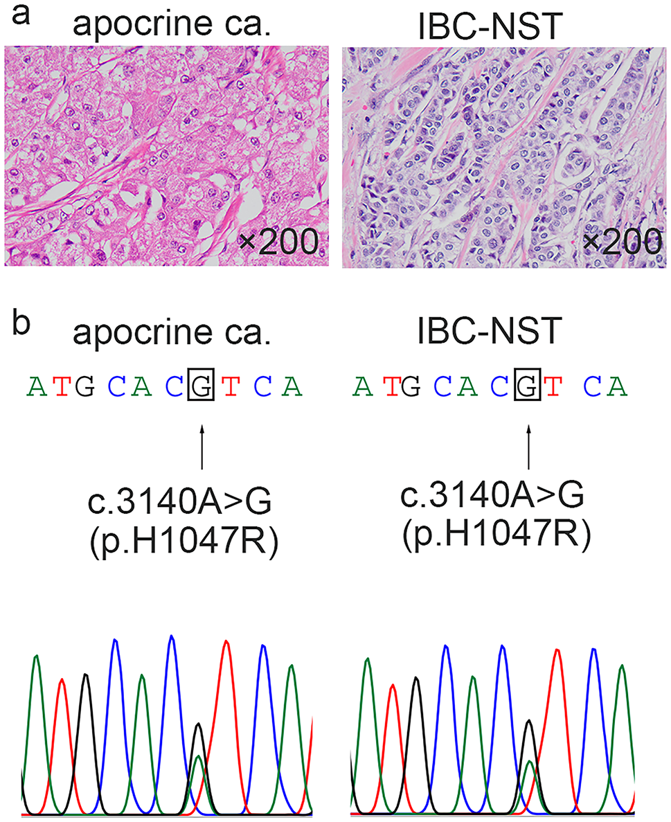 mutation in ER-negative and HER2-positive breast cancer with apocrine differentiation