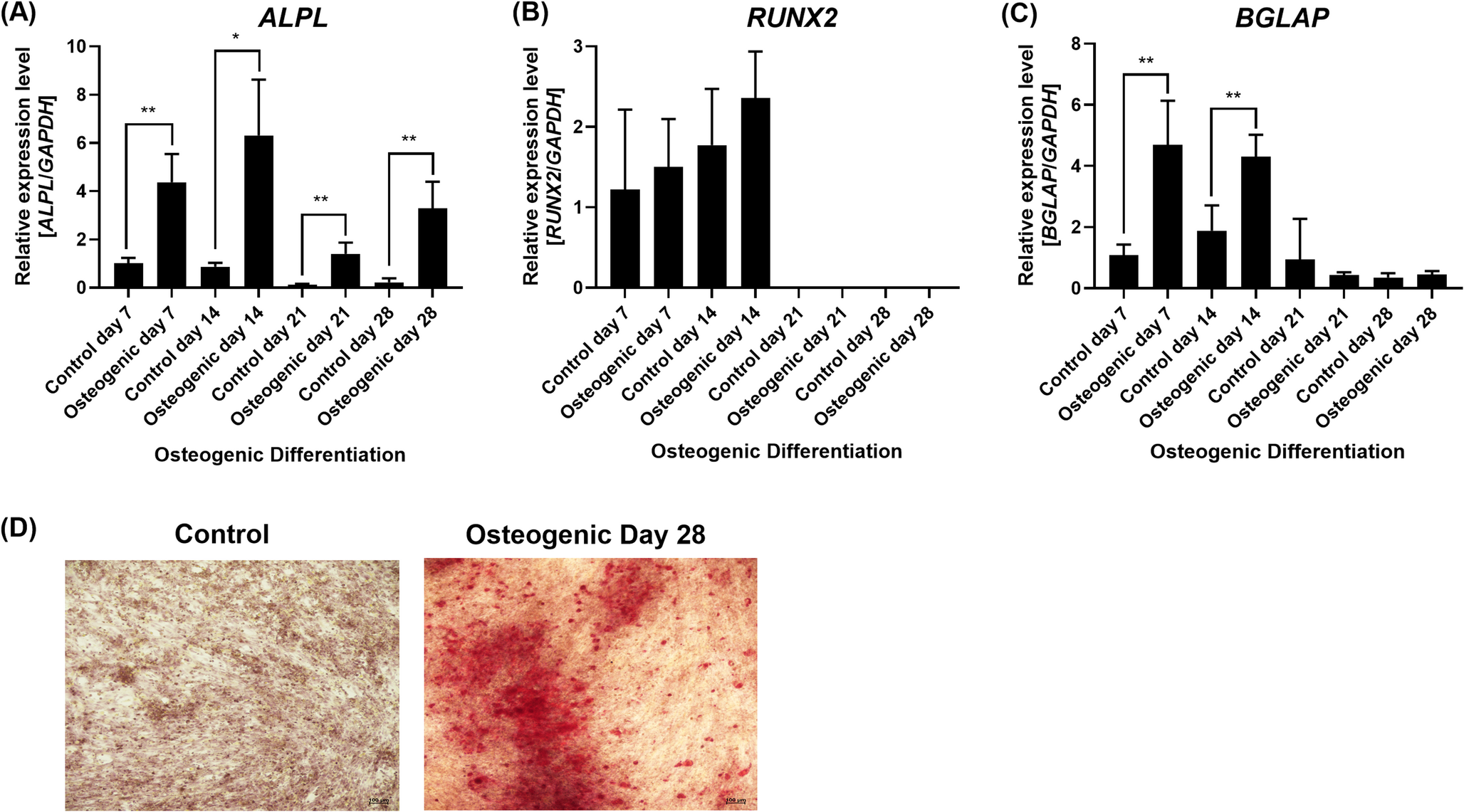 Expression Profile and Role of the  Genes During Human in vitro Osteogenic Differentiation