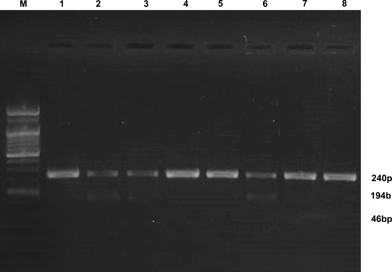 Molecular Epidemiological Analysis on  and Polymorphisms to Correlate Cancerous and Precancerous Lesions of Uterine Cervix
