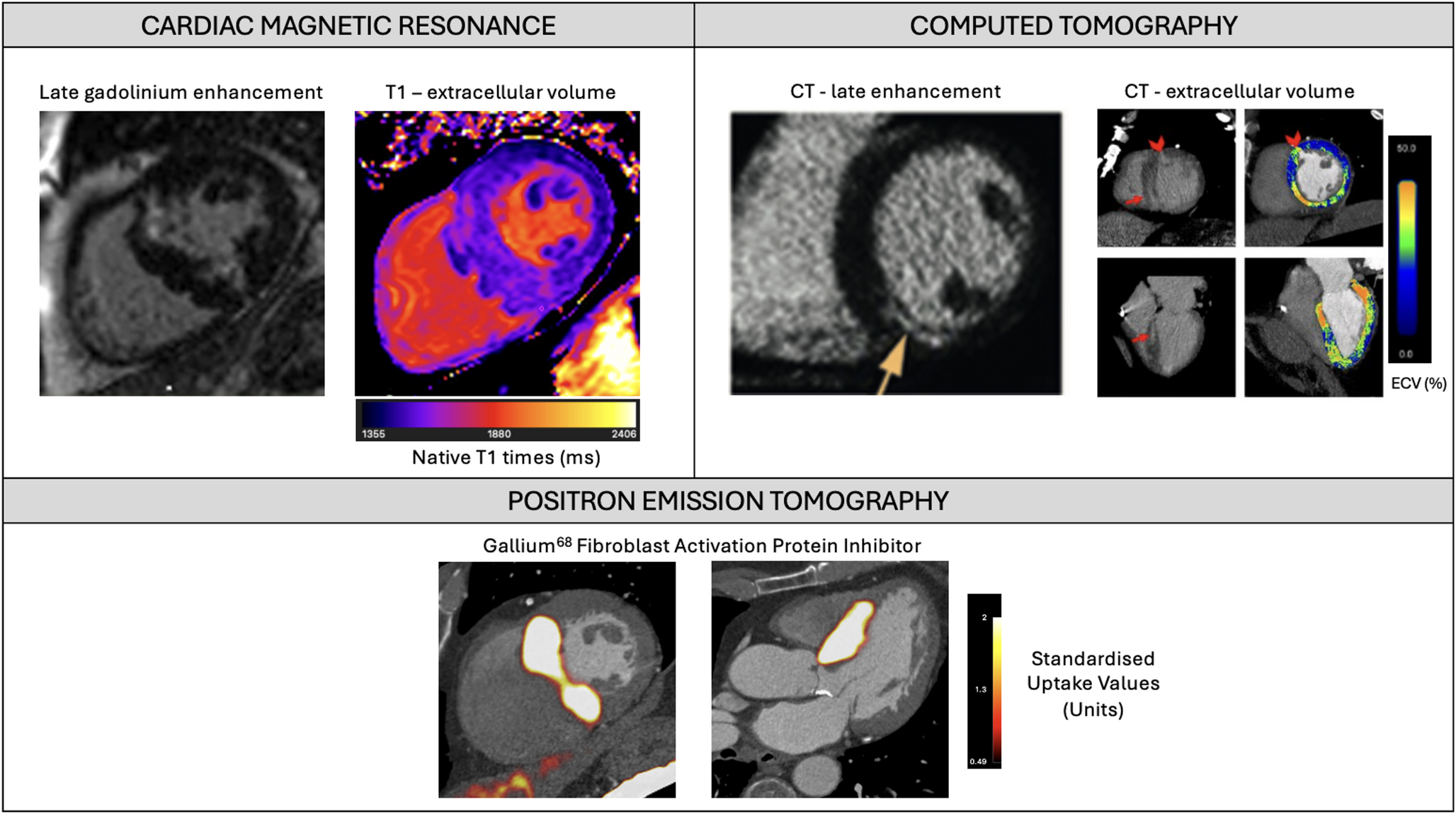 Next-generation molecular imaging of cardiac fibrosis