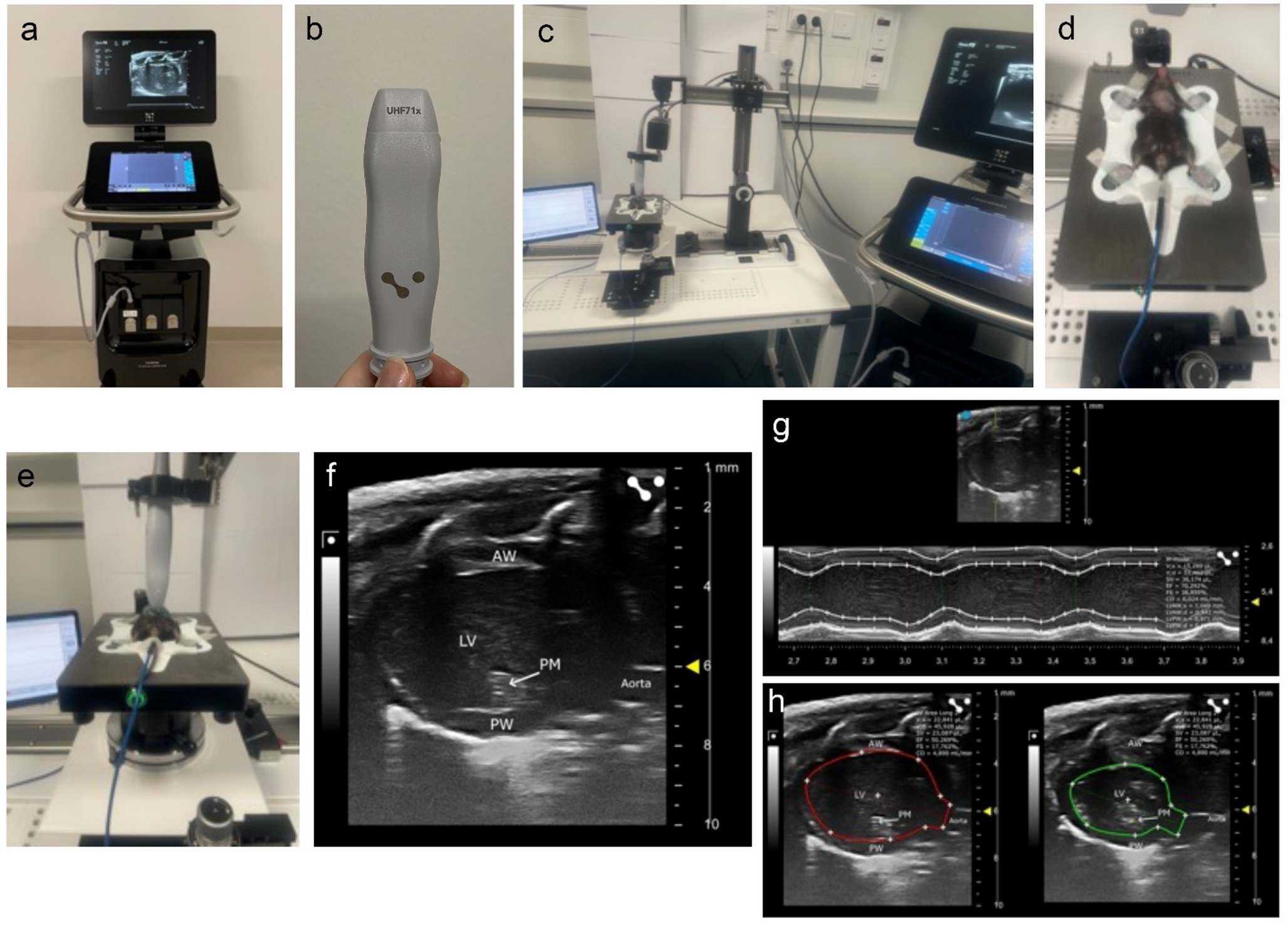 The impact of pericardial disruption on heart function and remodeling after myocardial infarction in mice
