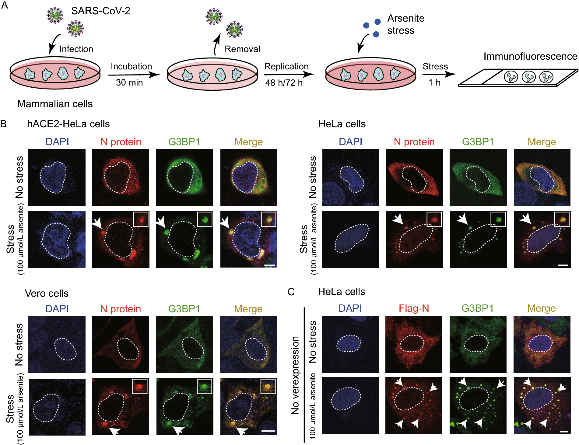 SARS-CoV-2 impairs the disassembly of stress granules and promotes ALS-associated amyloid aggregation