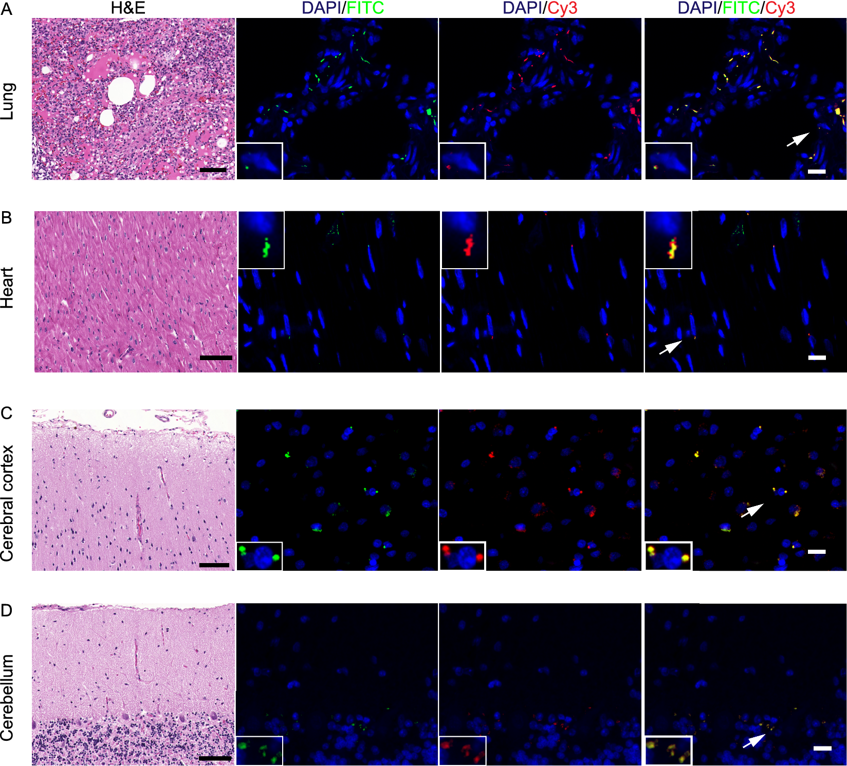 Differential transcriptomic landscapes of multiple organs from SARS-CoV-2 early infected rhesus macaques