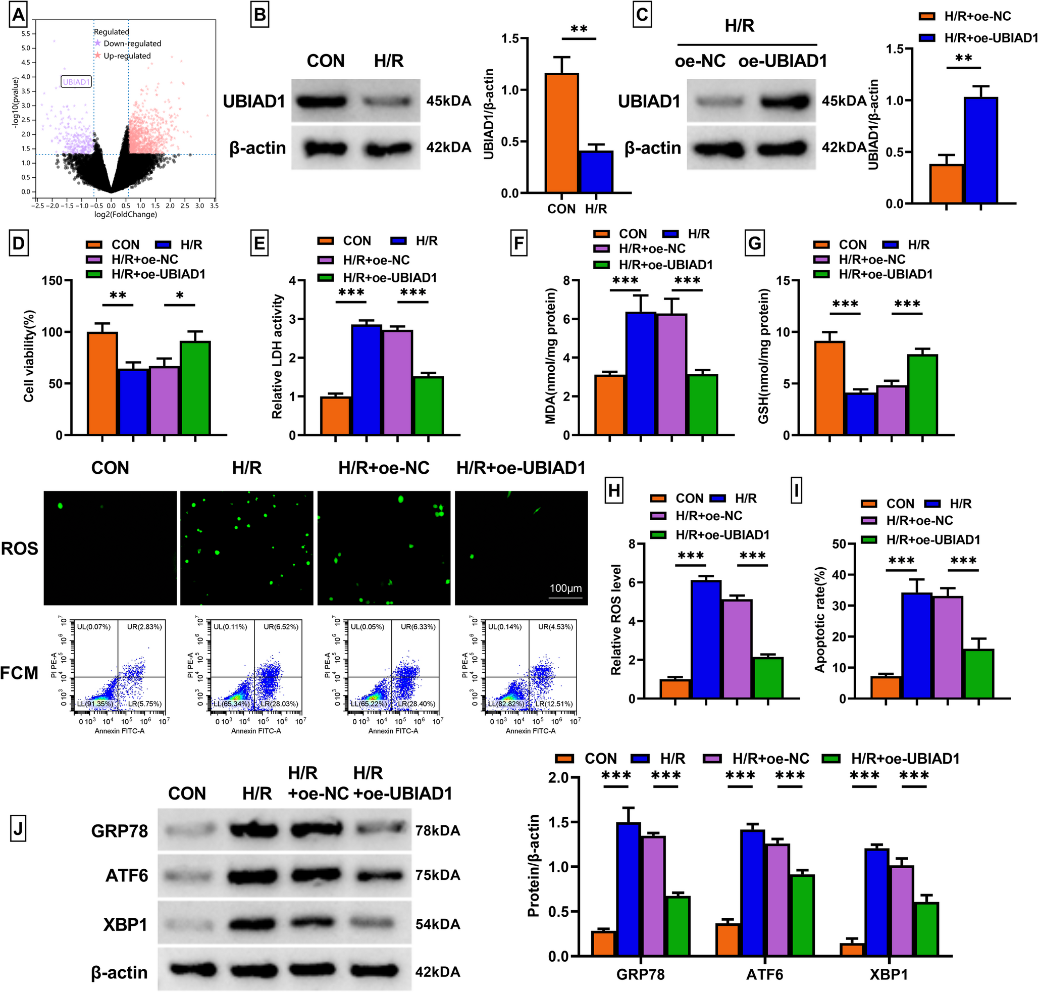 Mesenchymal stem cell-originated exosomal ZEB1 alleviates hypoxia/reperfusion-induced apoptosis, oxidative stress, and endoplasmic reticulum stress in cardiomyocytes via regulating UBIAD1