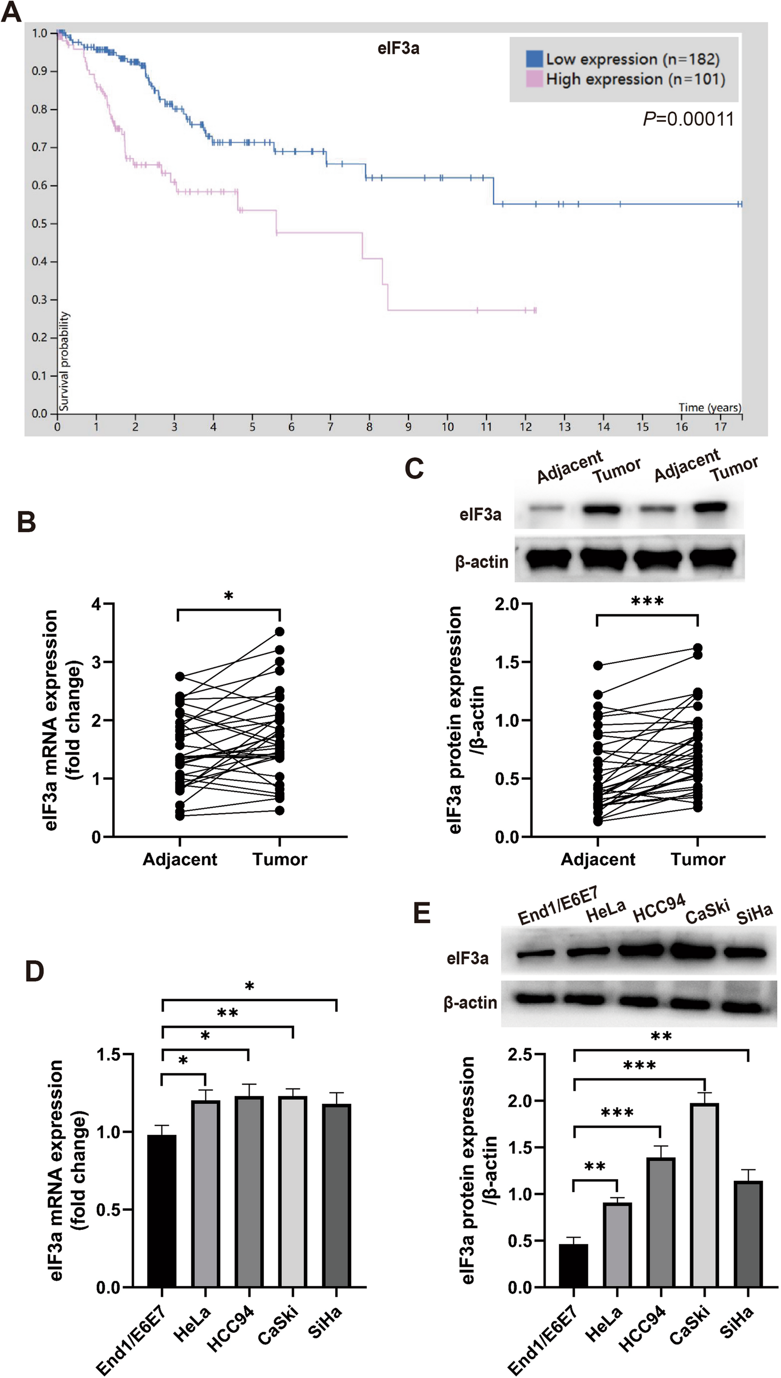 The eIF3a/m6A/ENO1 axis orchestrates glycolytic reprogramming and cell growth in cervical cancer