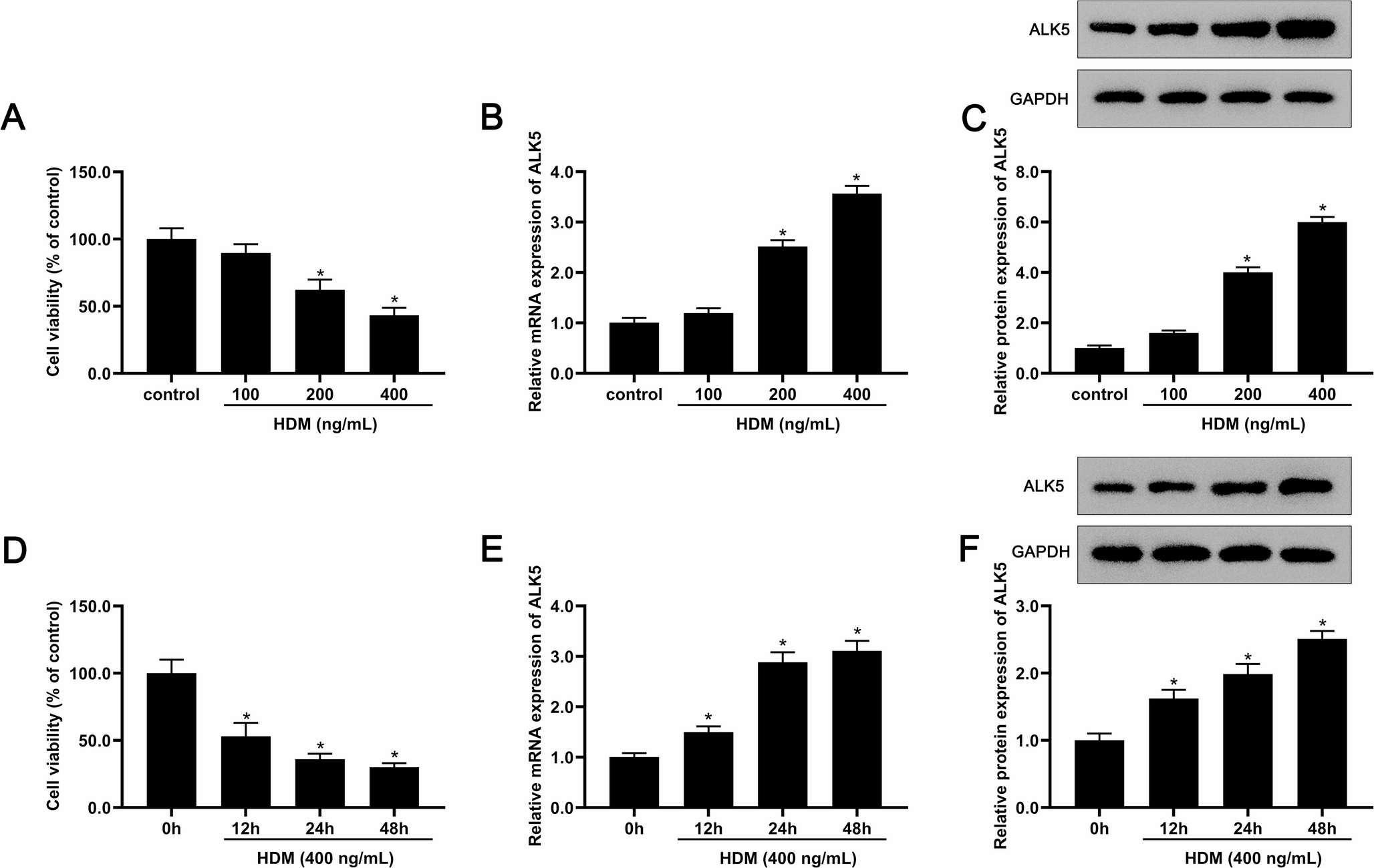 ALK5 inhibition reduces HDM-induced inflammation and oxidative injury by regulating KLF4-mediated glycolysis in BEAS-2B cells