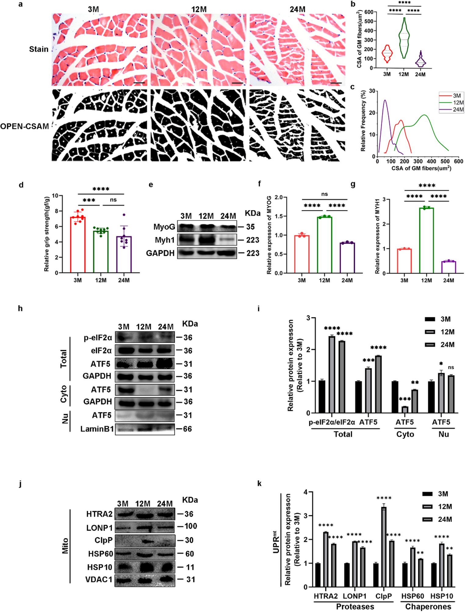 CD36 regulates myogenic differentiation via chronic integrated stress response – implications for muscle aging