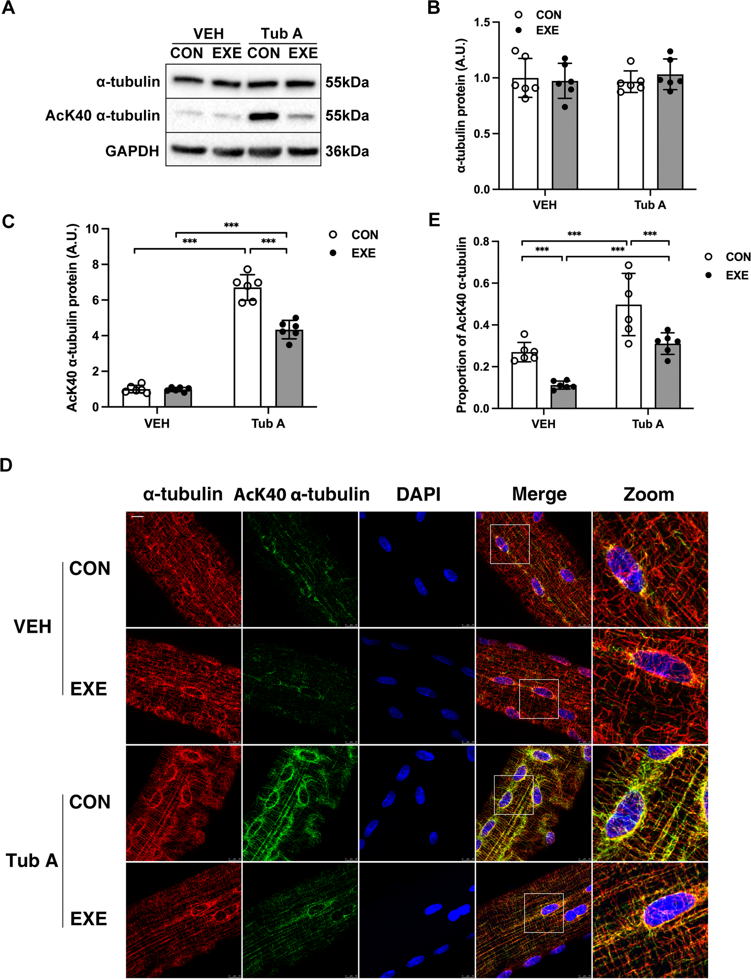 Tubastatin A attenuates impaired autophagic degradation and promotes myogenic program in skeletal muscle following downhill running