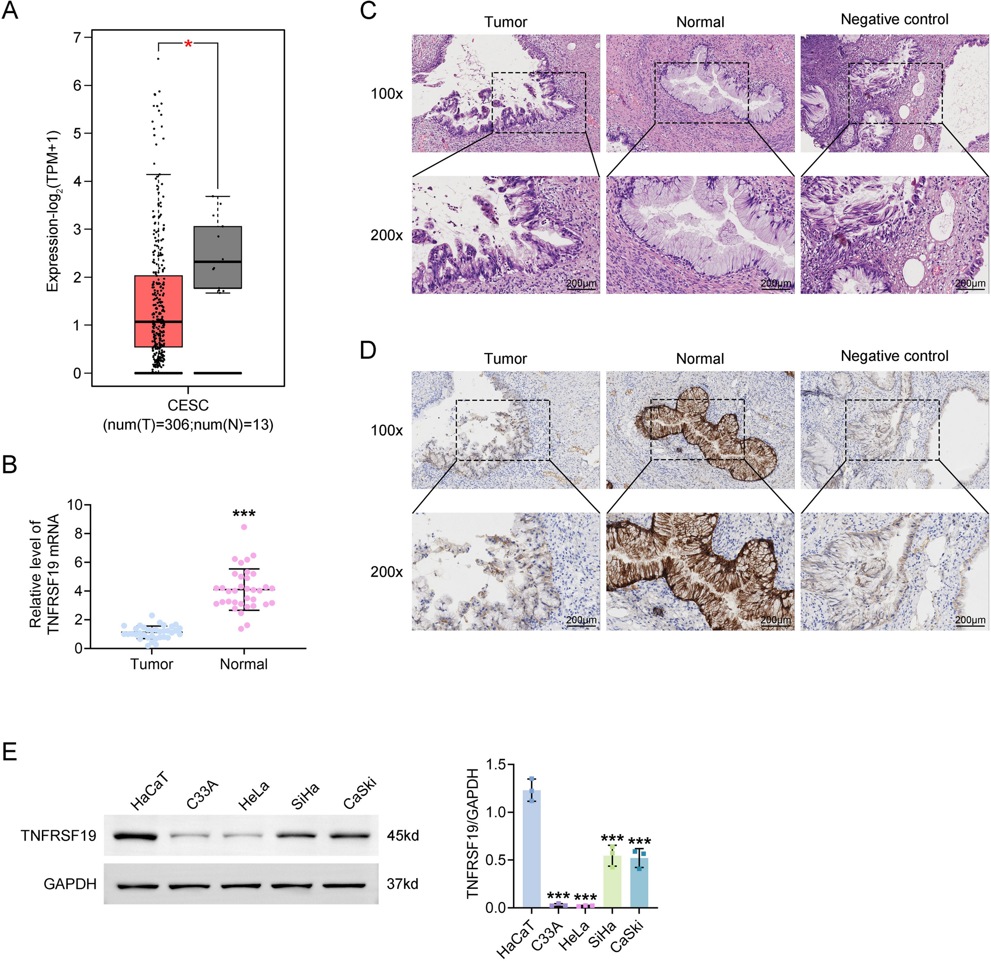 Unveiling TNFRSF19: a novel tumor suppressor targeting endoplasmic reticulum stress and LGR5/Wnt/β-catenin in cervical cancer