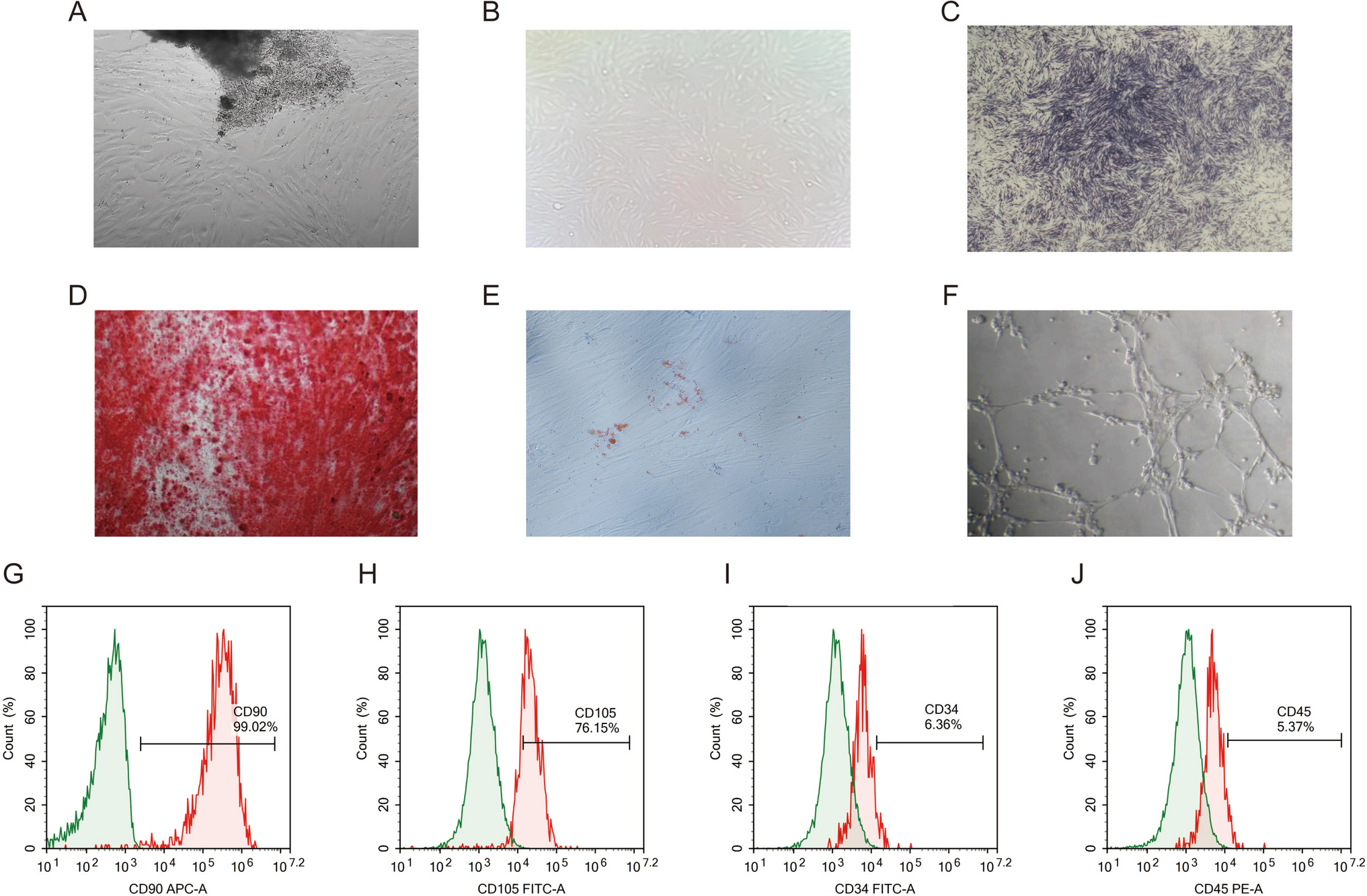 DKK1 exacerbates dental pulp inflammation: insights from RNA-sequencing analysis