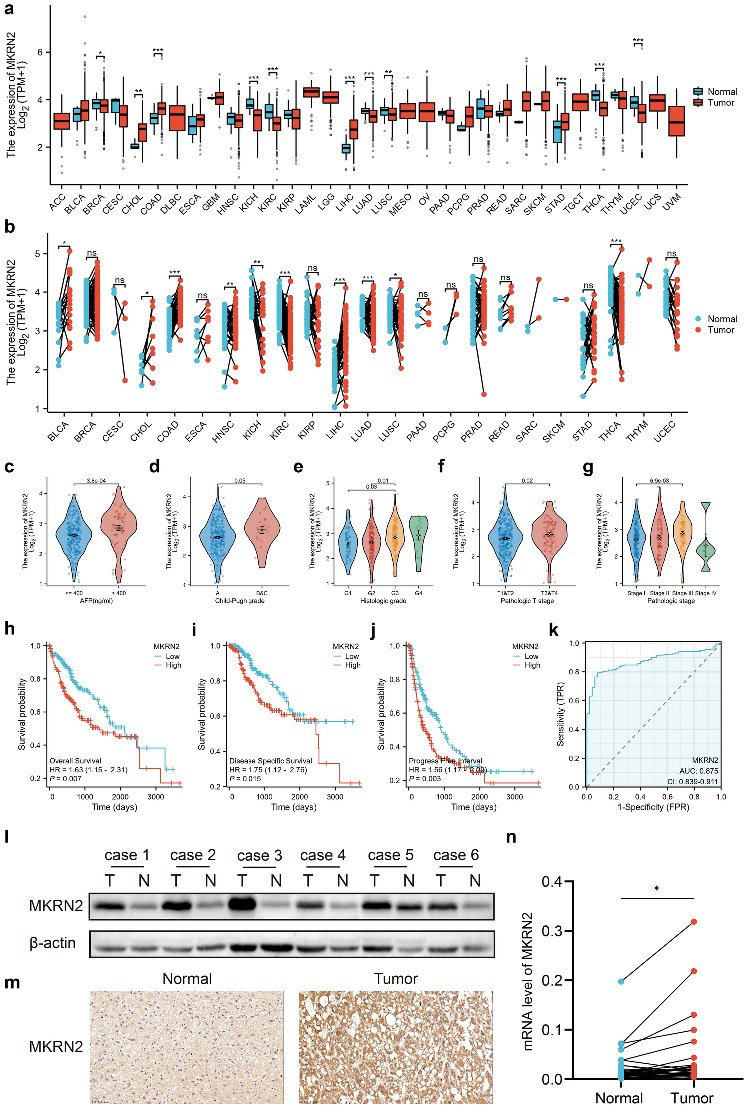 MKRN2 enhances hepatocellular carcinoma proliferation through the p38 MAPK pathway
