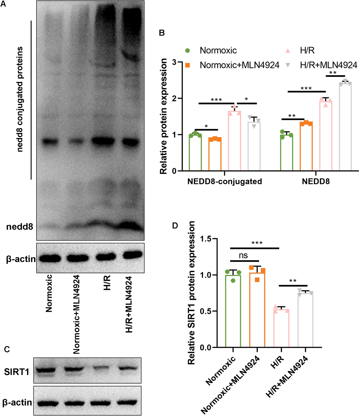 SIRT1 reduced DDX5 neddylation to attenuate myocardial ischemia/reperfusion injury