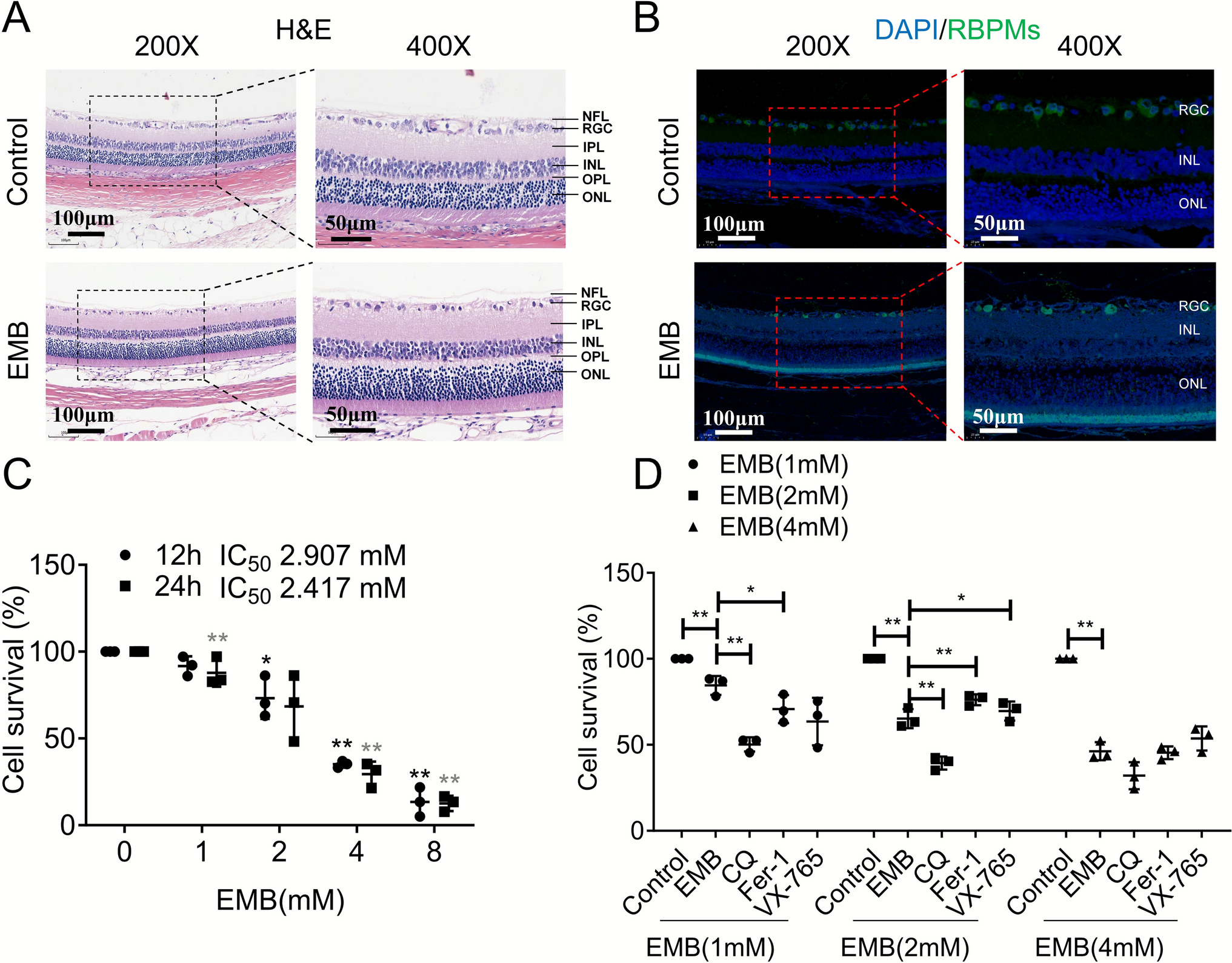 Ethambutol induces optic neuropathy through SDHB-mediated ferroptosis in retinal ganglion cells via Smad4 pathway