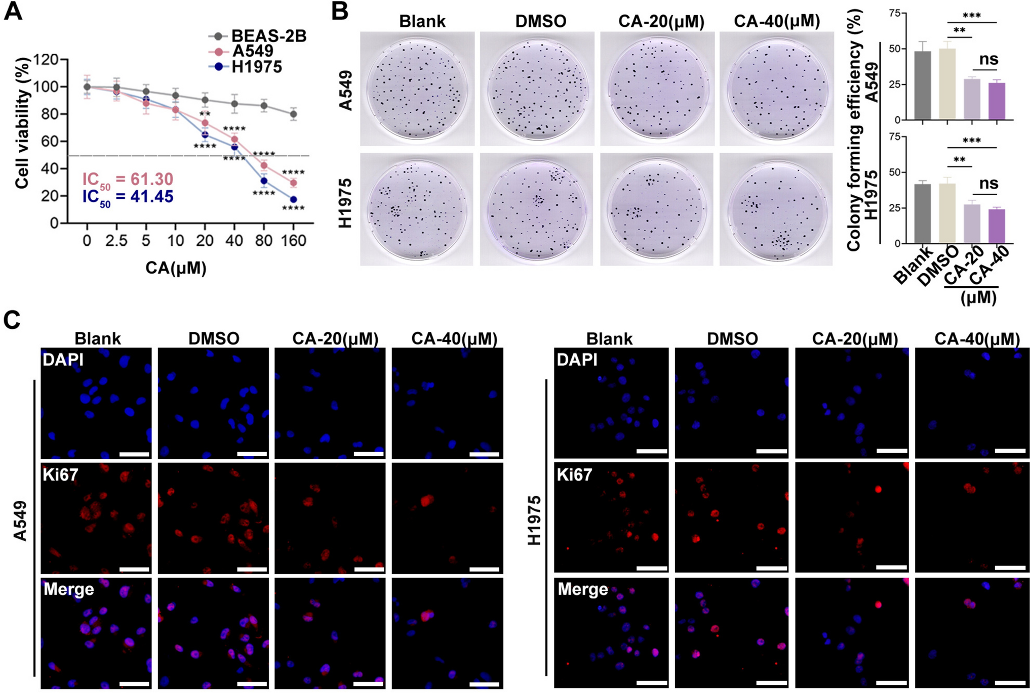 Chebulagic acid targets FBXO38 to enhance natural killer cell-mediated anti-tumor immunity in lung adenocarcinoma