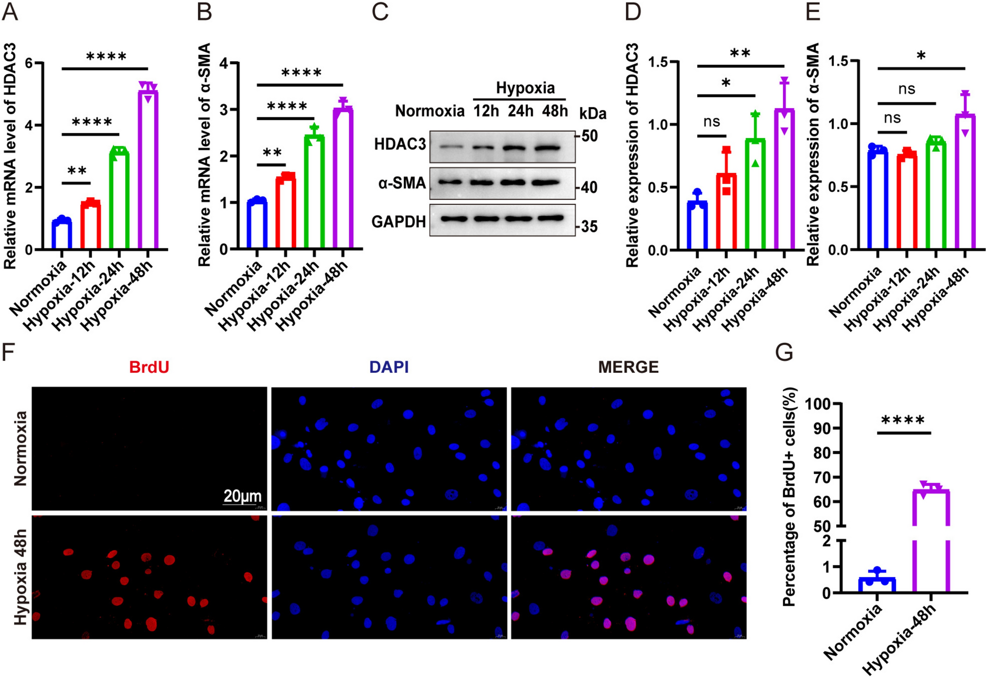 Histone deacetylase 3 promotes hypoxia-induced human pulmonary arterial smooth muscle cell proliferation by modulating the CSF2-JAK2-STAT5 signaling pathway