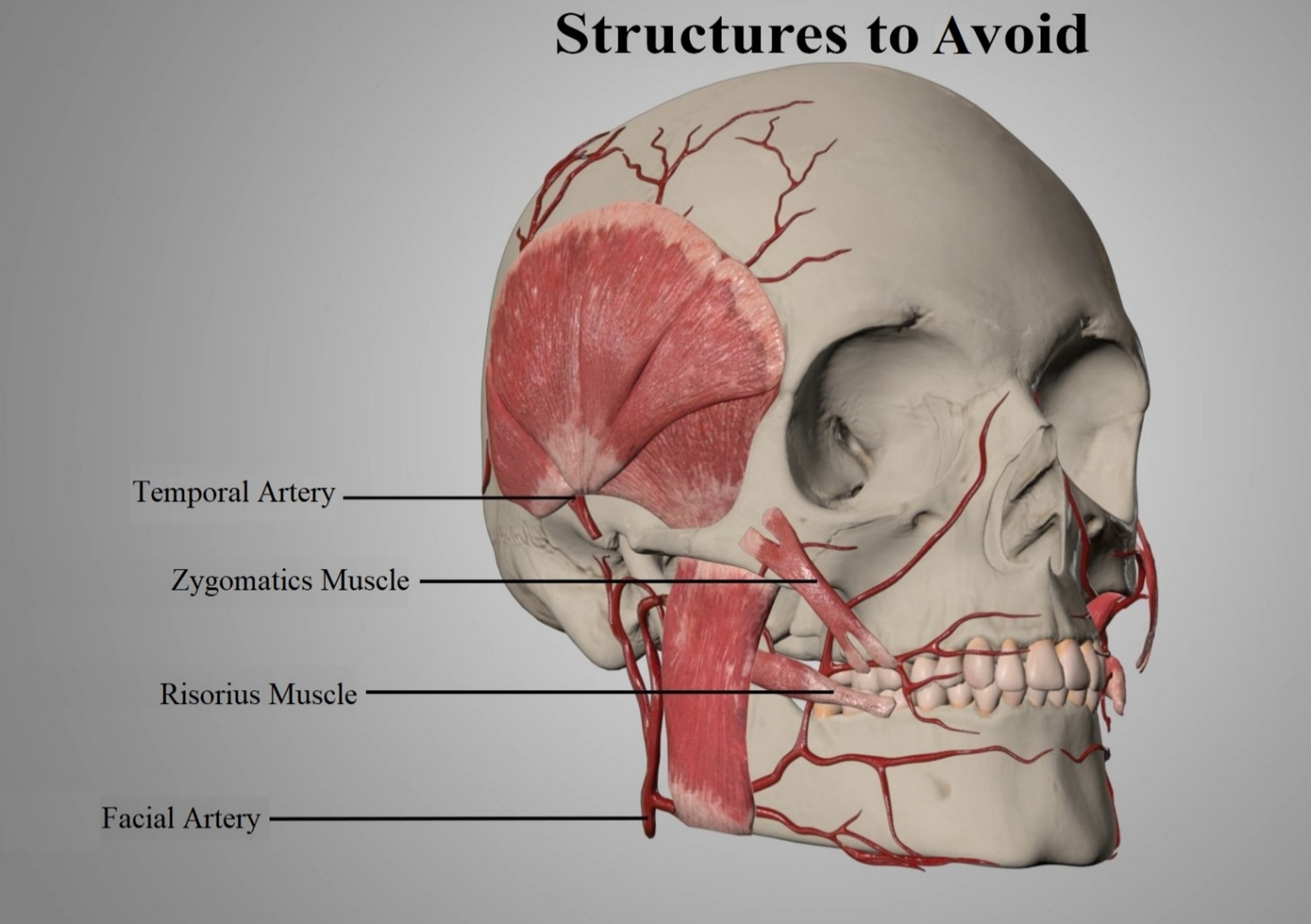 The Management of Myogenous Temporomandibular Disorders with Botulinum Toxin: A Narrative Review and Management Recommendations