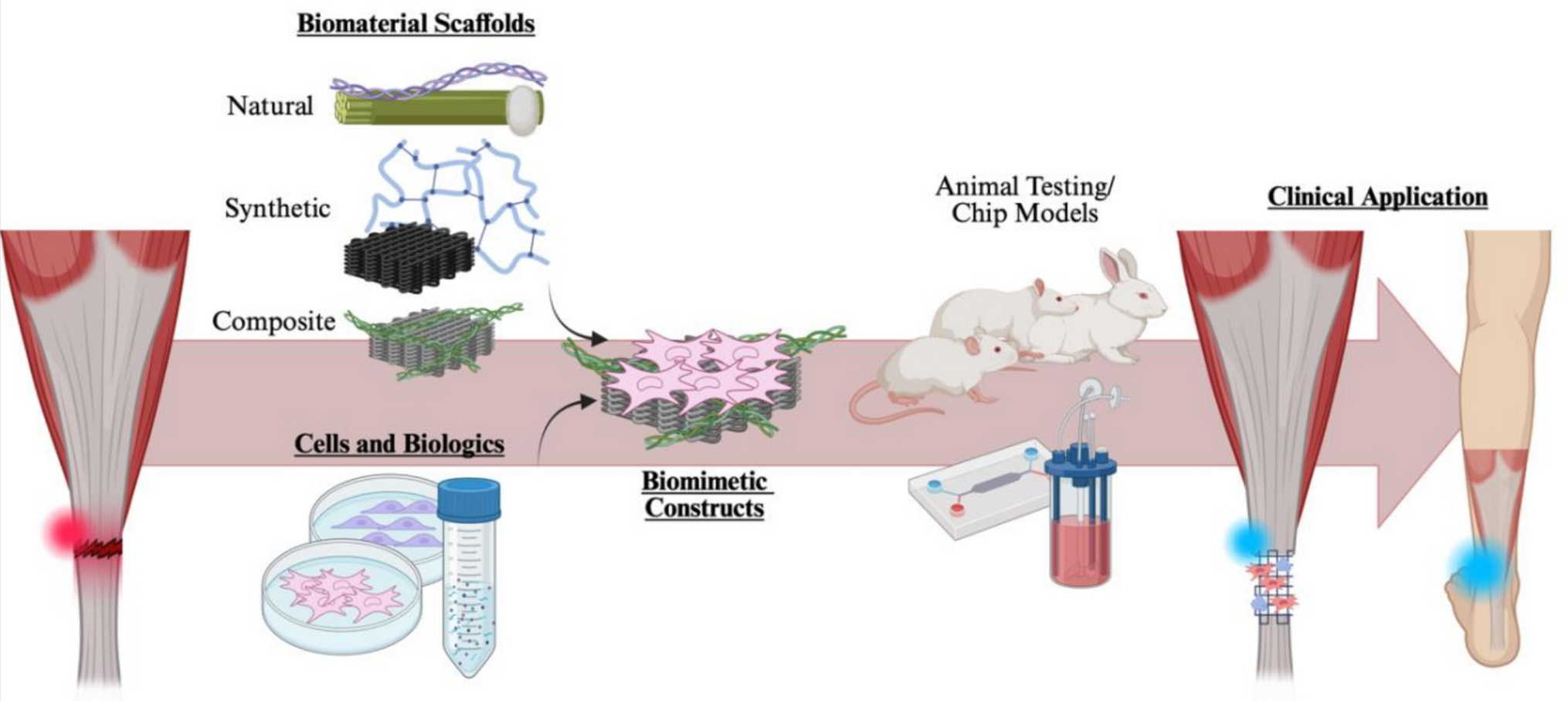 Biomimetic Constructs for Achilles Tendon Regeneration and their Translation to Human Medicine