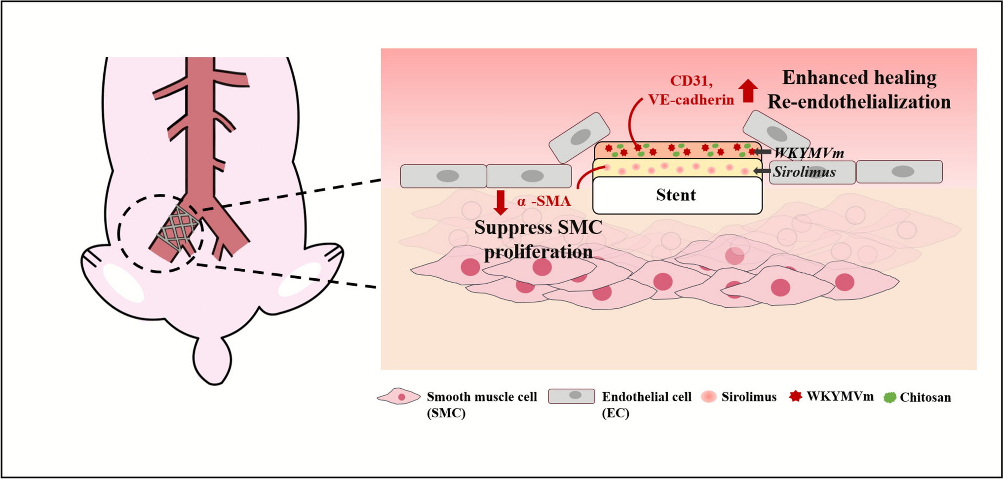 Dual-Drug Stent with Sirolimus and WKYMVm Promotes Endothelialization and Limits Hyperplasia