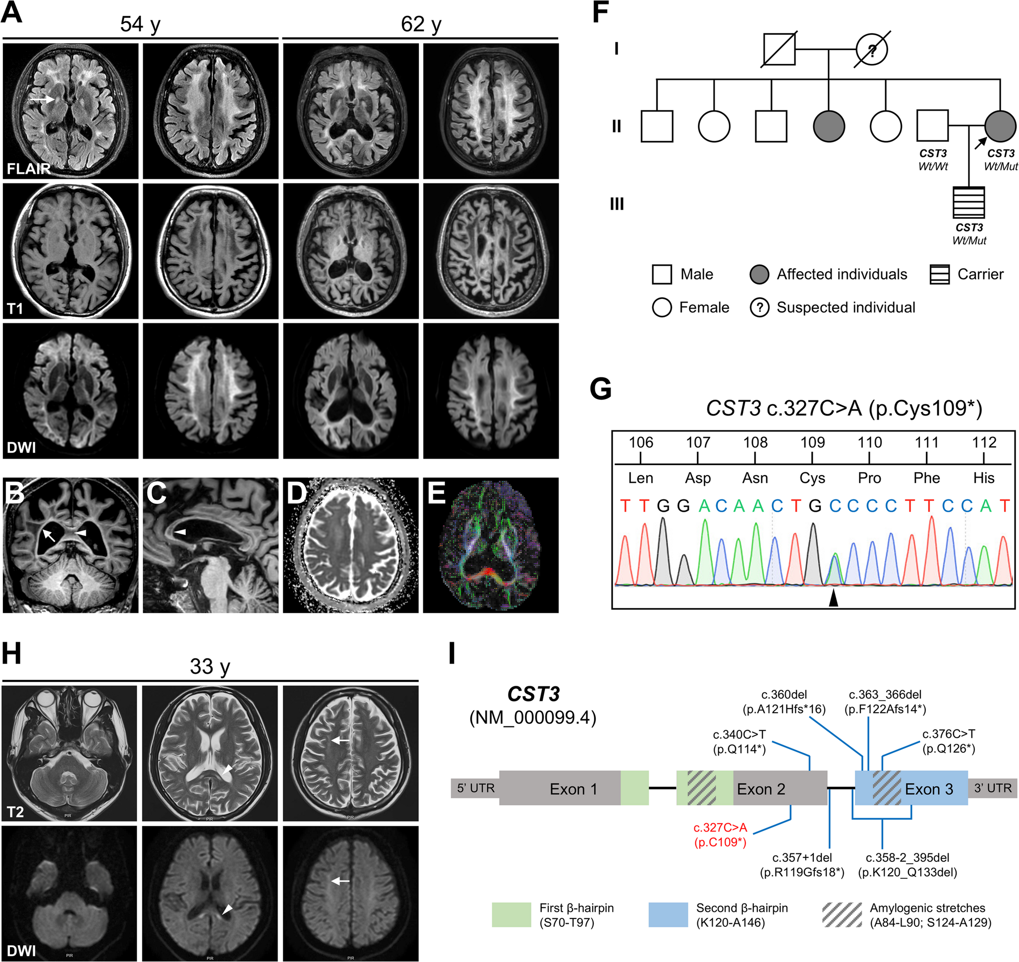 Expanding mutational and phenotypic spectrum of -related leukoencephalopathy: a novel family and literature review
