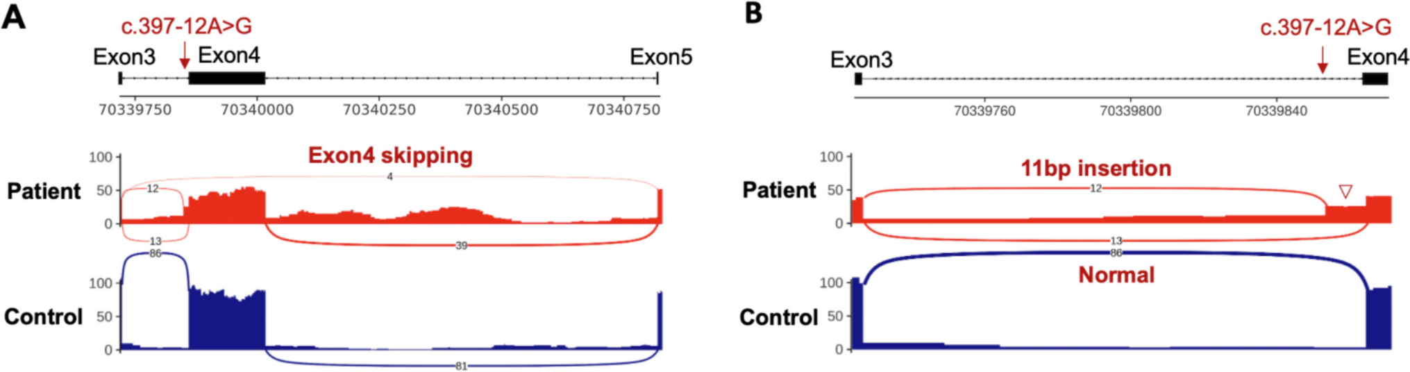 Thorough evaluation of a novel splice variant in a female patient with -related intellectual disability