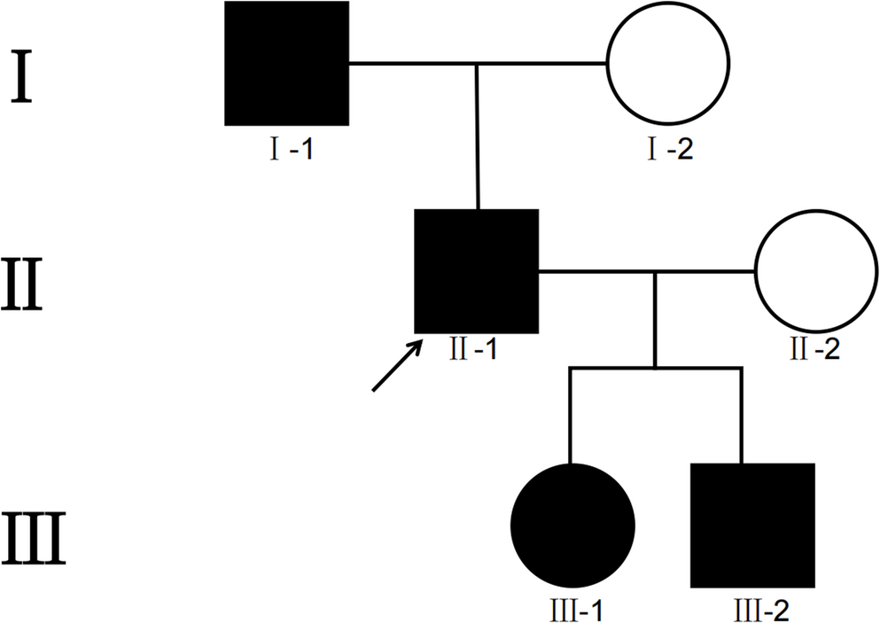 Association of TRPM7 gene mutation with familial vestibular migraine