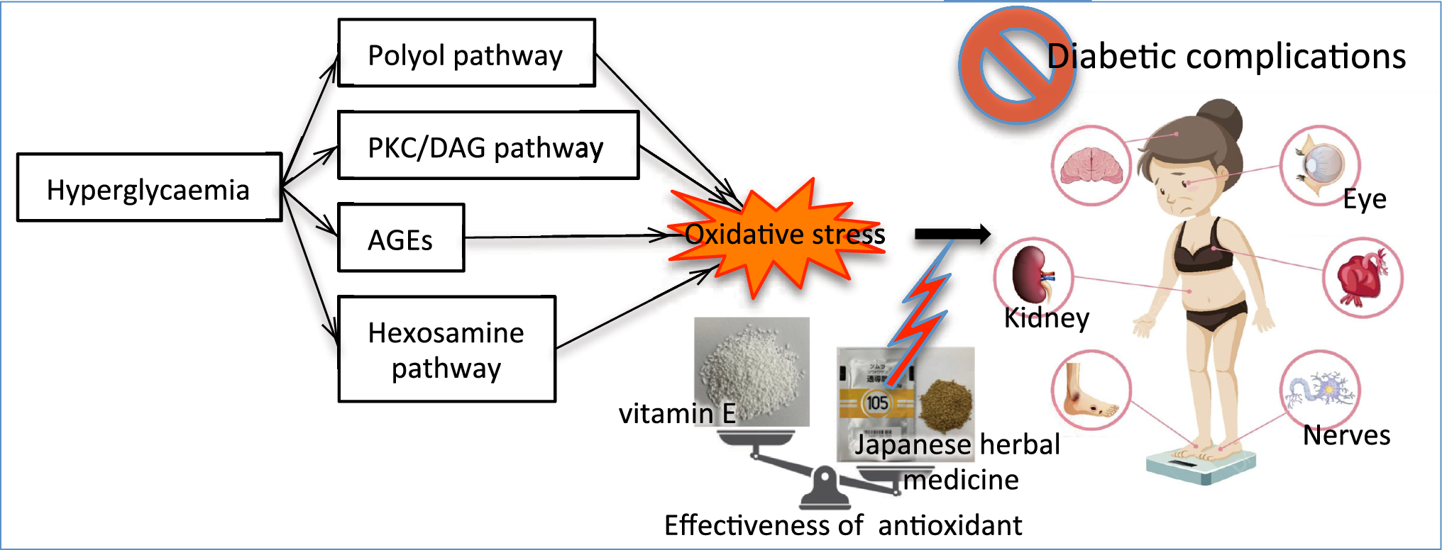 Antioxidative Japanese herbal medicine formula prevents diabetic renal complications