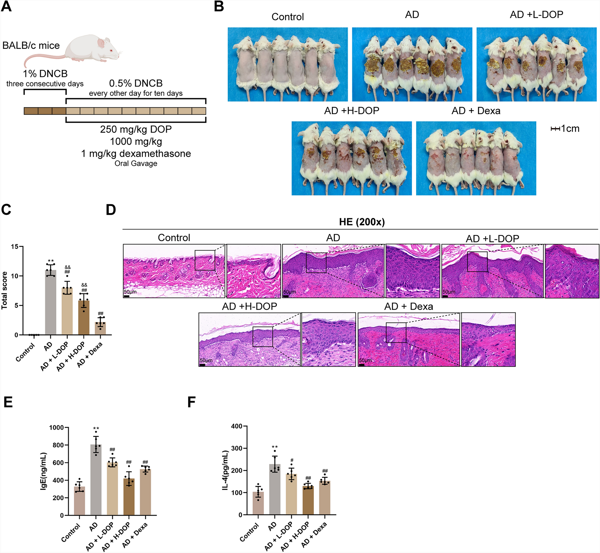 polysaccharides alleviate atopic dermatitis in vivo and in vitro through inhibition of inflammation and mitochondrial dysfunction