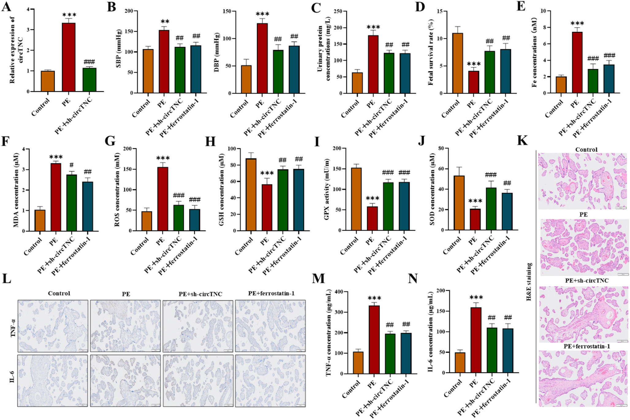 Disrupting the circTNC/miR-582-5p/MAPK8 axis alleviates oxidative stress-induced trophoblast dysfunction in preeclampsia