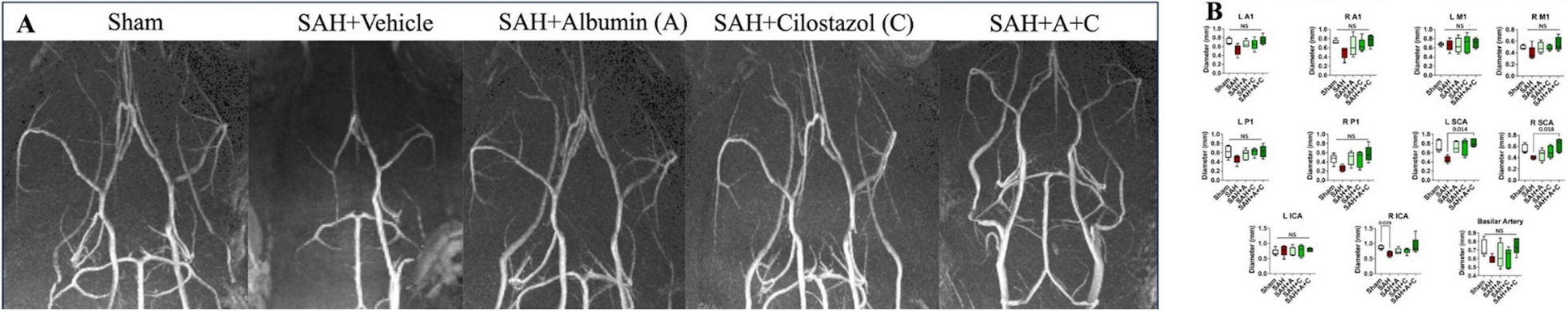Combination of Albumin and Cilostazol Improves Outcomes in a Rodent Model of Aneurysmal Subarachnoid Hemorrhage