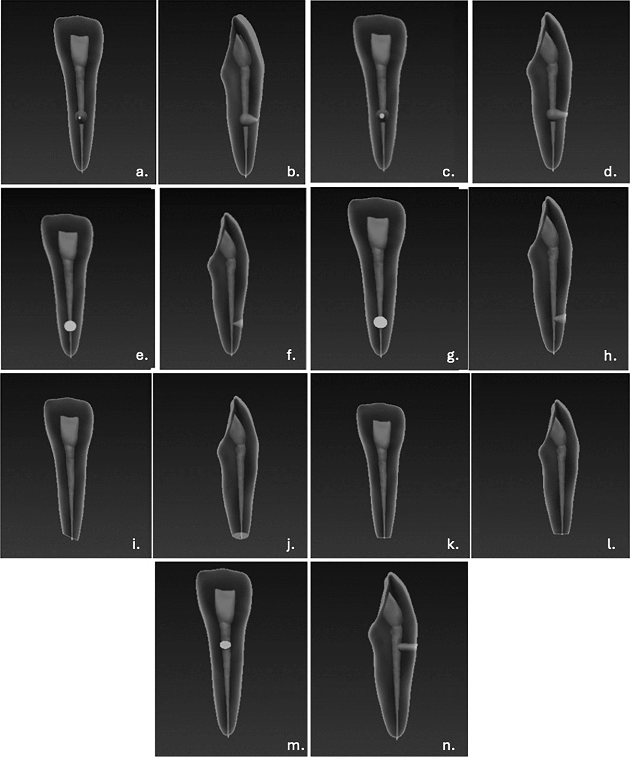 Accuracy of wireless electronic apex locators in teeth with different types of root resorption: a 3D-printed tooth model study