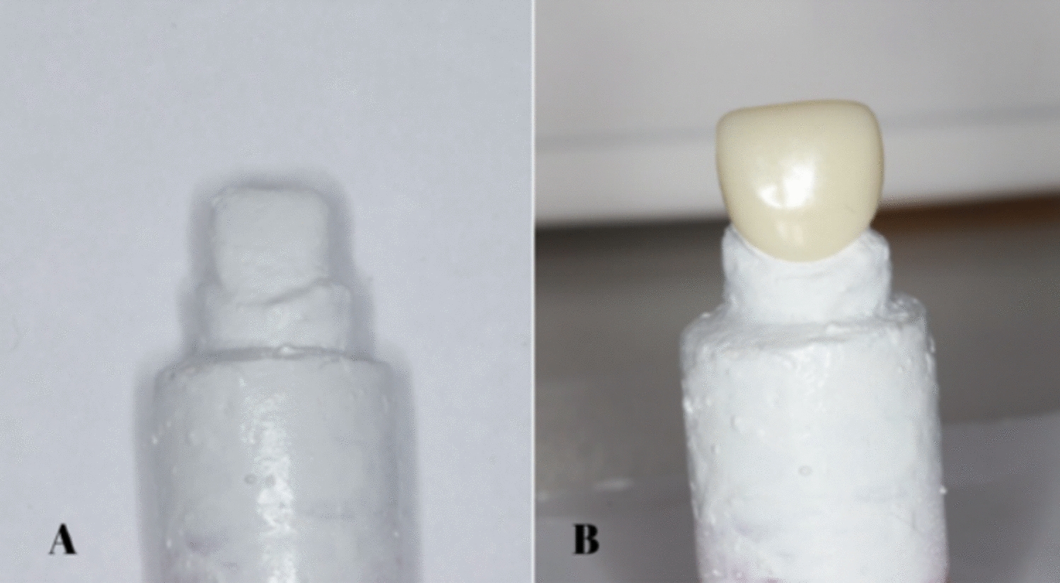 Effect of acidic exposure on the optical and mechanical properties of esthetic pediatric restorative materials: an in vitro study