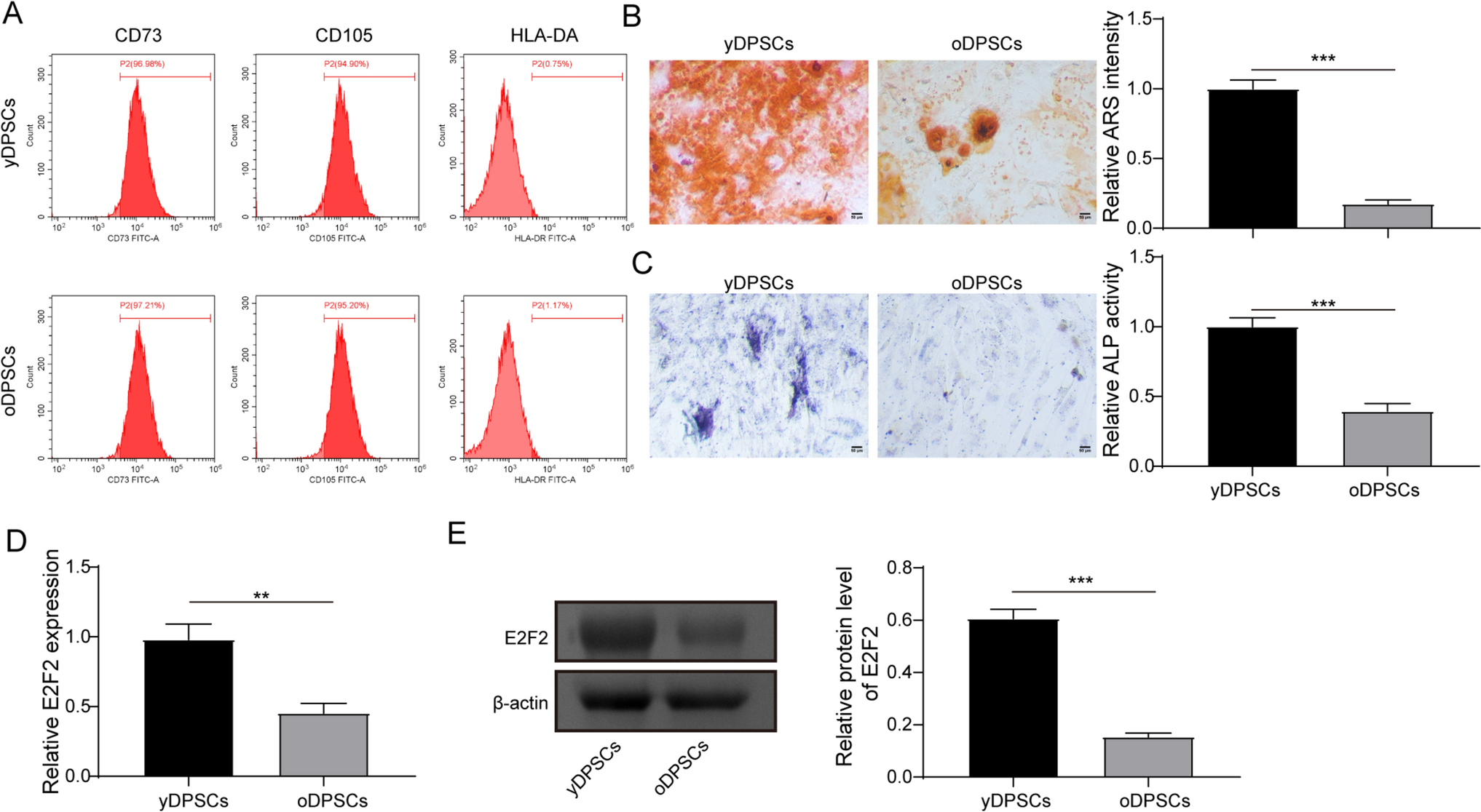 E2F2 suppresses cell senescence and promotes odontogenic differentiation in dental pulp stem cells by stabilizing METTL3