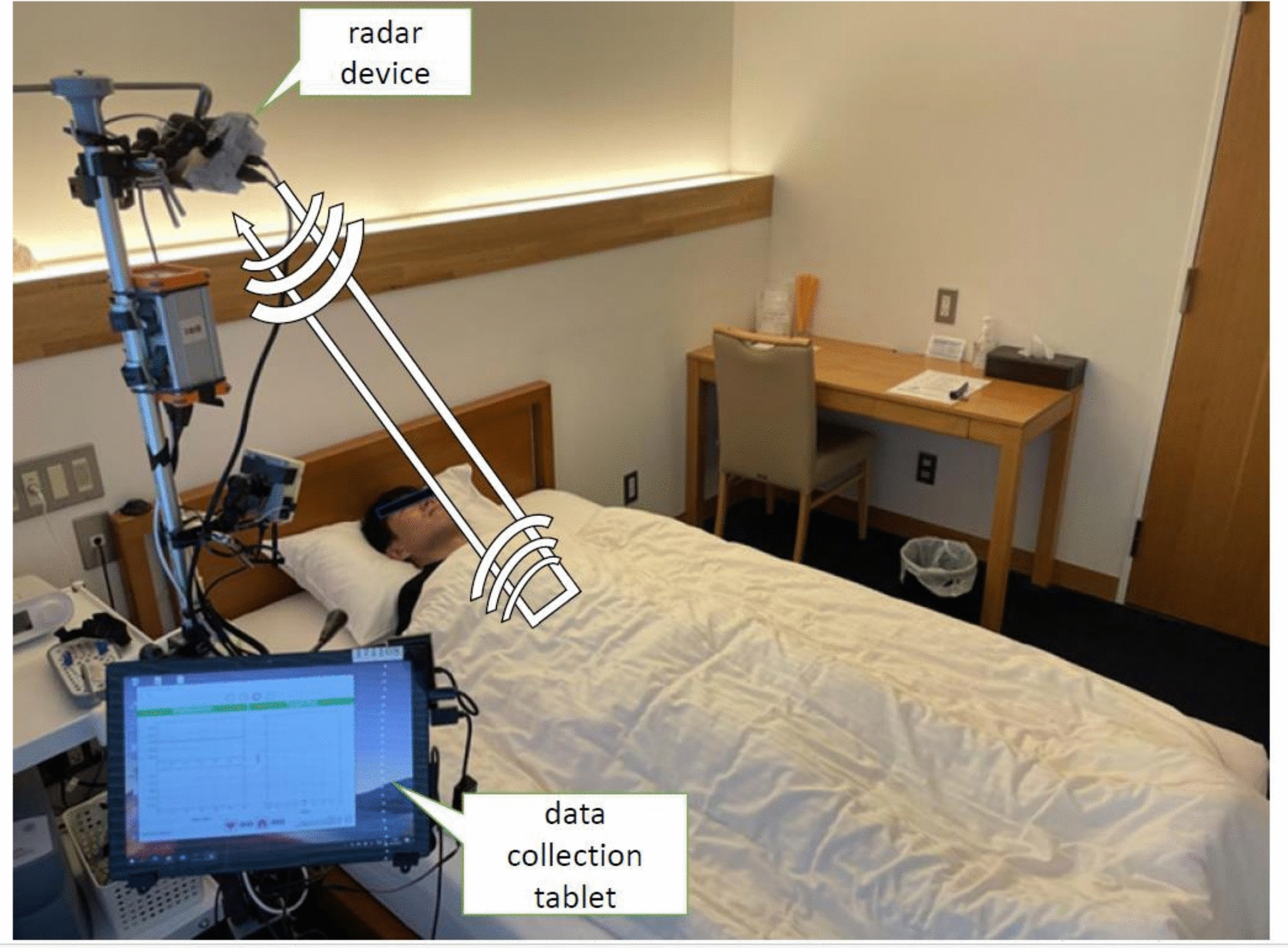 Simultaneous estimation of sleep duration and sleep apnea–hypopnea using millimeter-wave radar