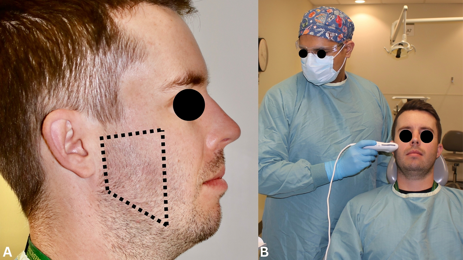 Handheld point-of-care ultrasound for chairside assessment of masseter muscle: a pilot study