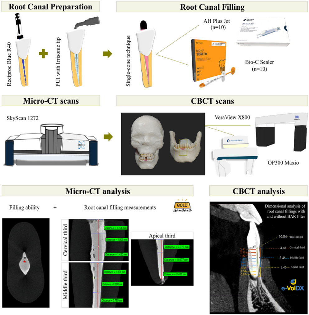 Filling ability and blooming artifact expression in long-oval root canals: influence of CBCT device, endodontic sealer, and BAR filter